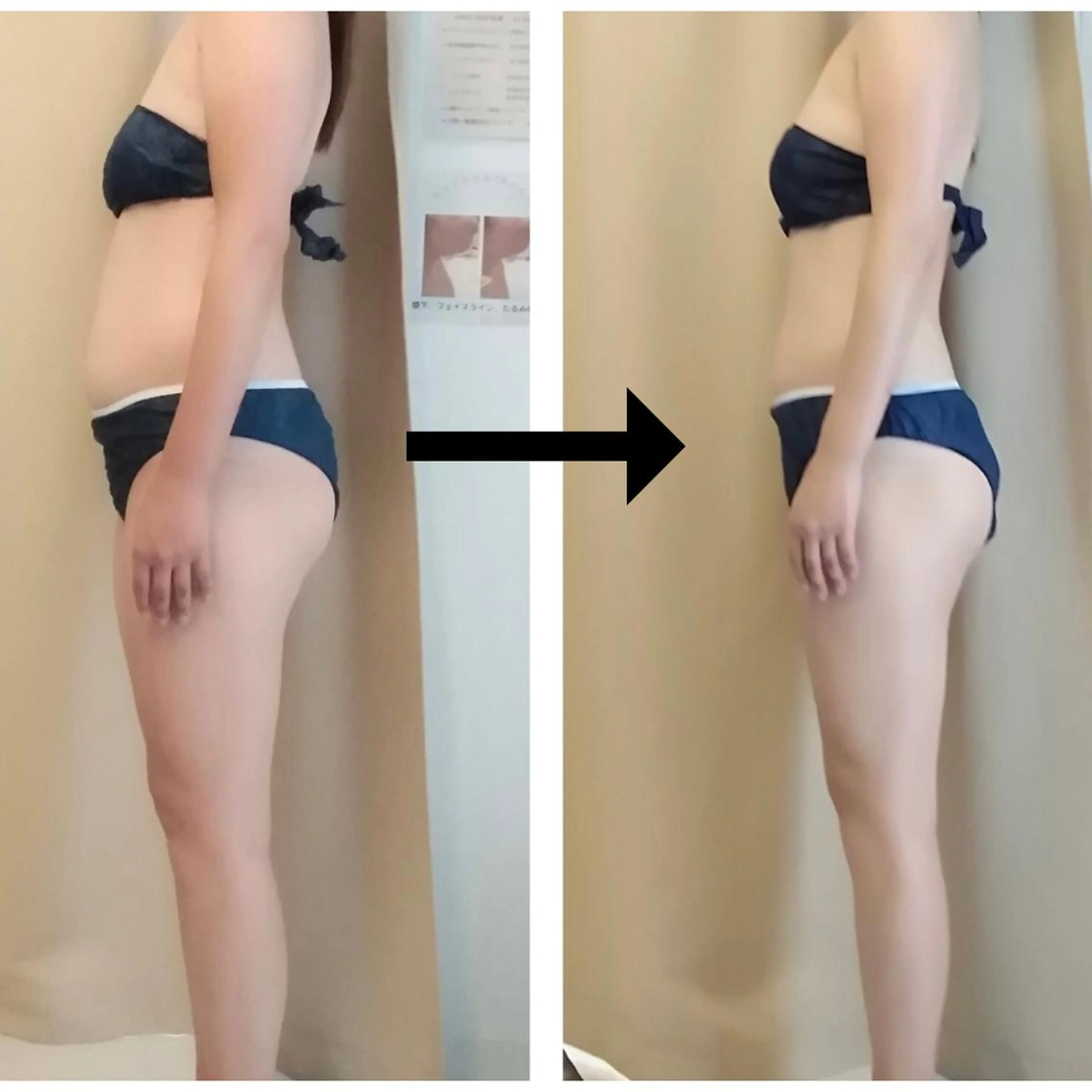 痩身専門サロン ビューティーグランツのエステ・リラクイメージ