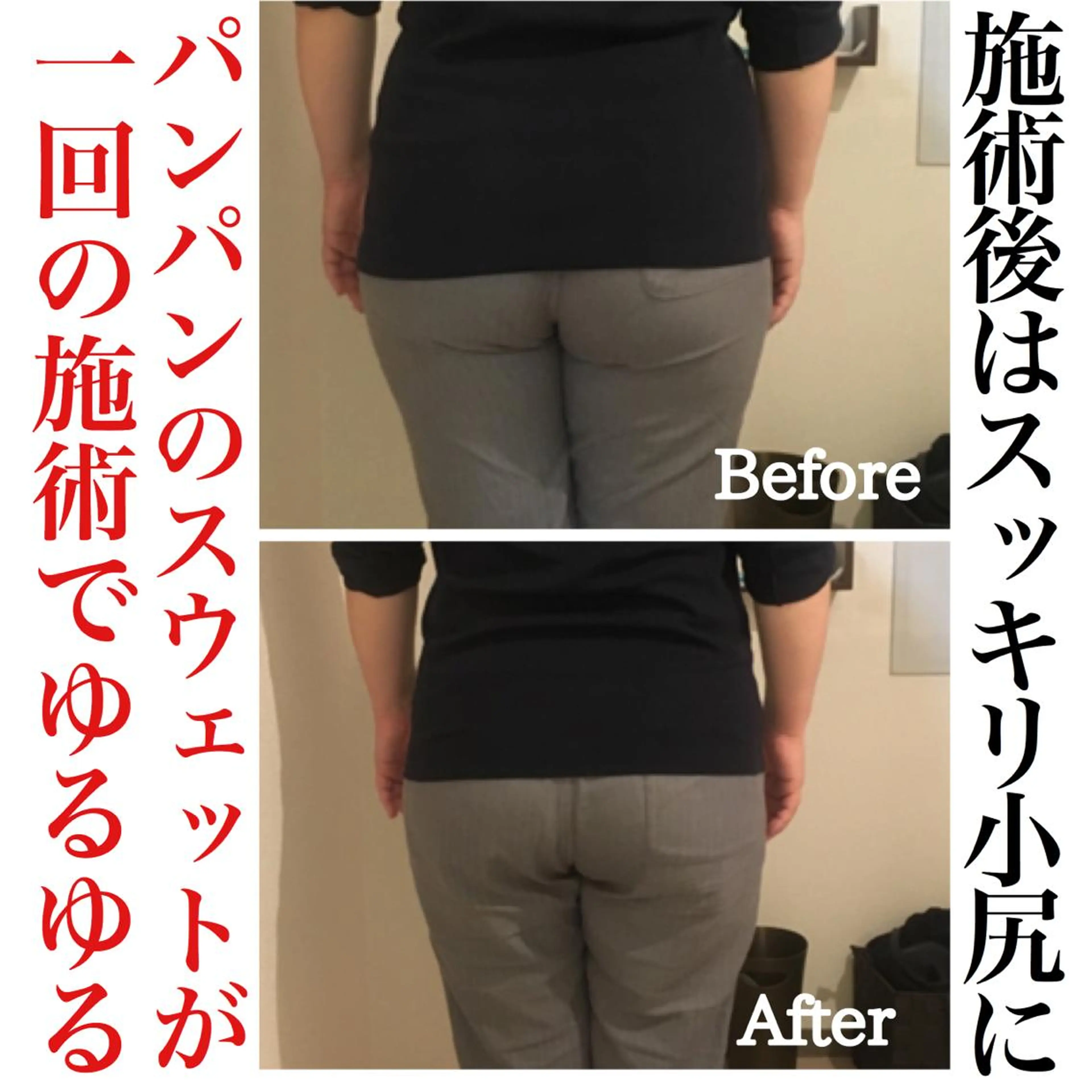 リプラス整体院所属・Re+(リプラス整体 院:やまみち)のエステ・リラクイメージ