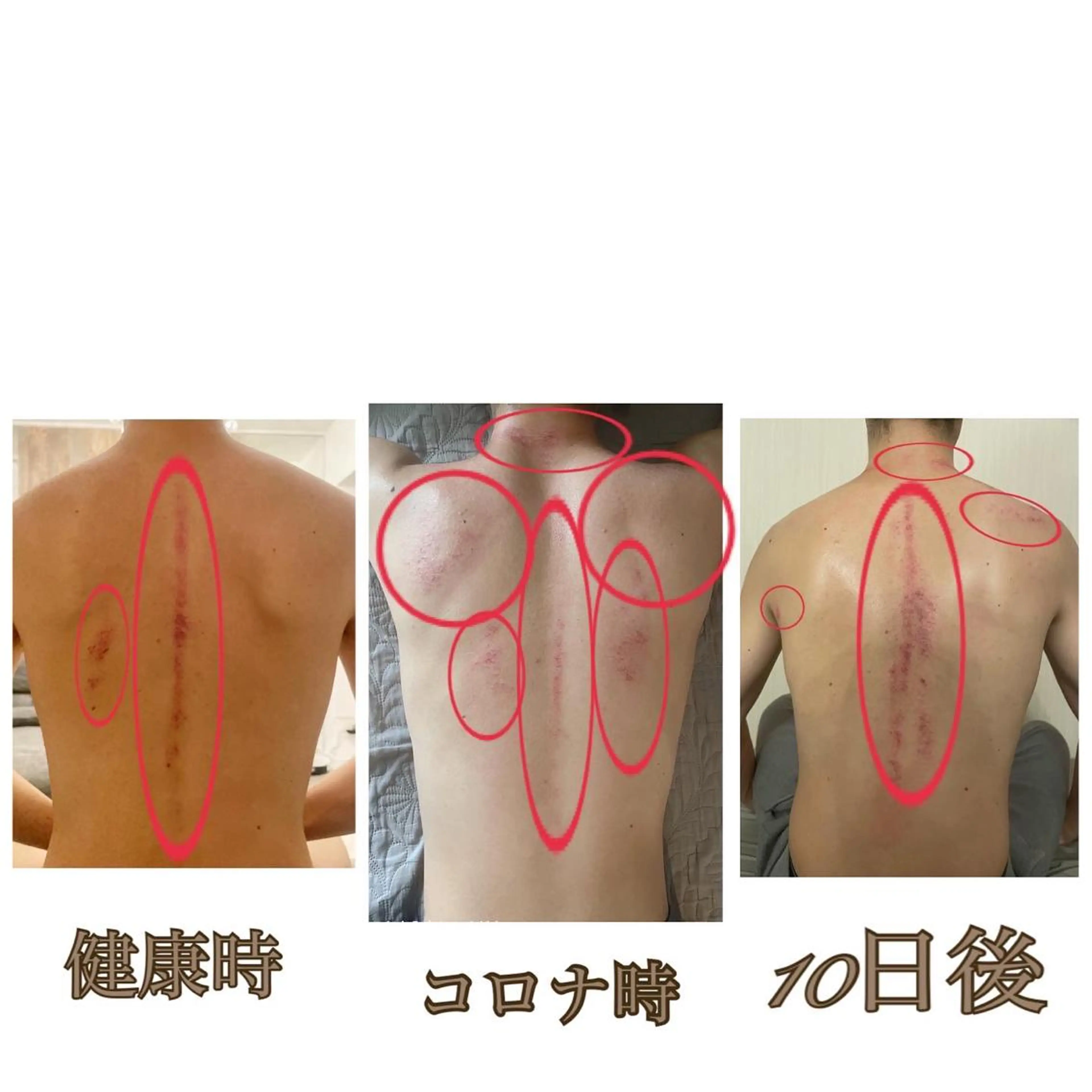 美腸専門 漢方よもぎ蒸しのエステ・リラクイメージ