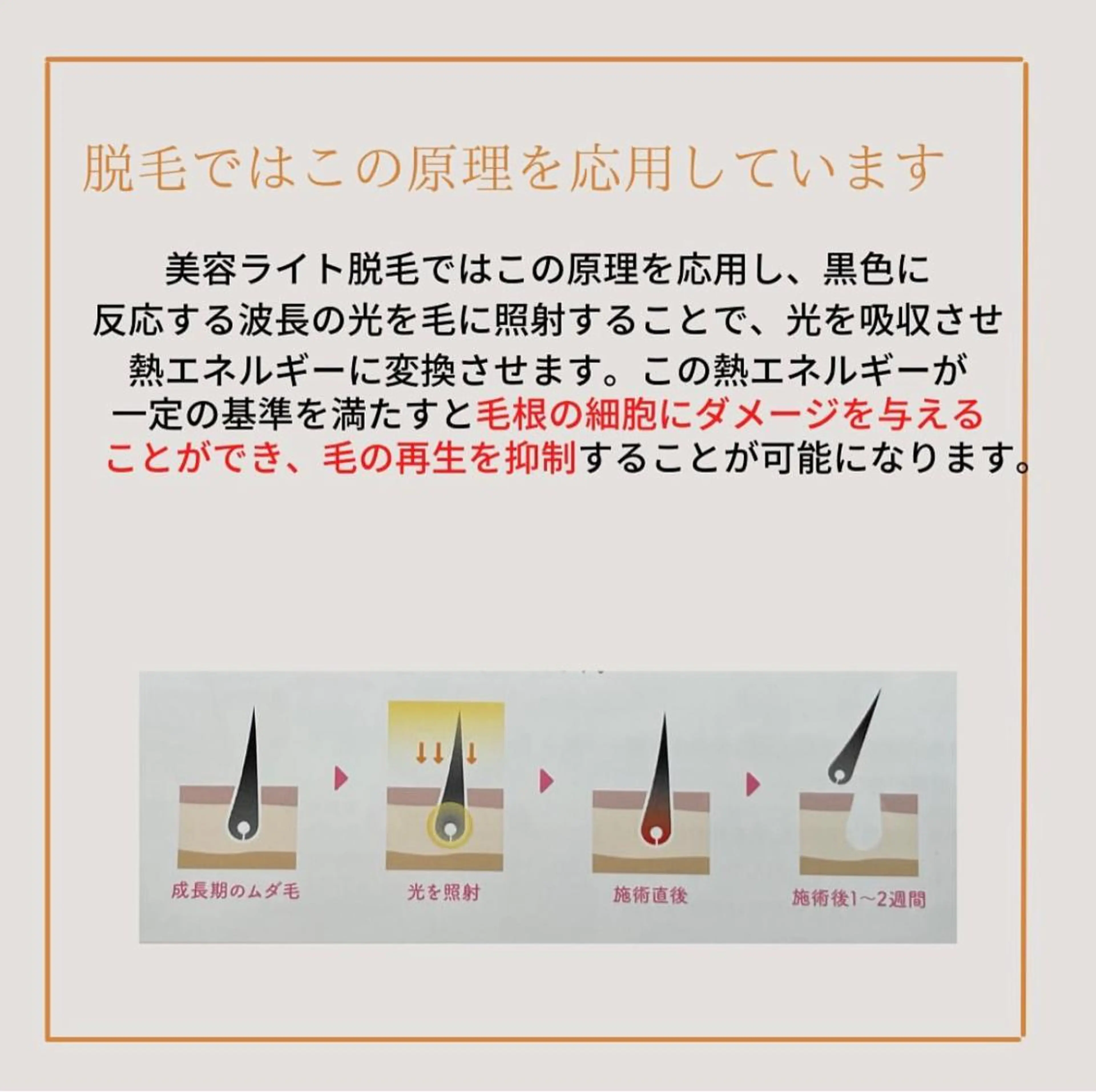 calimelo所属・calimero 美肌脱毛サロンの眉毛・アイブロウイメージ