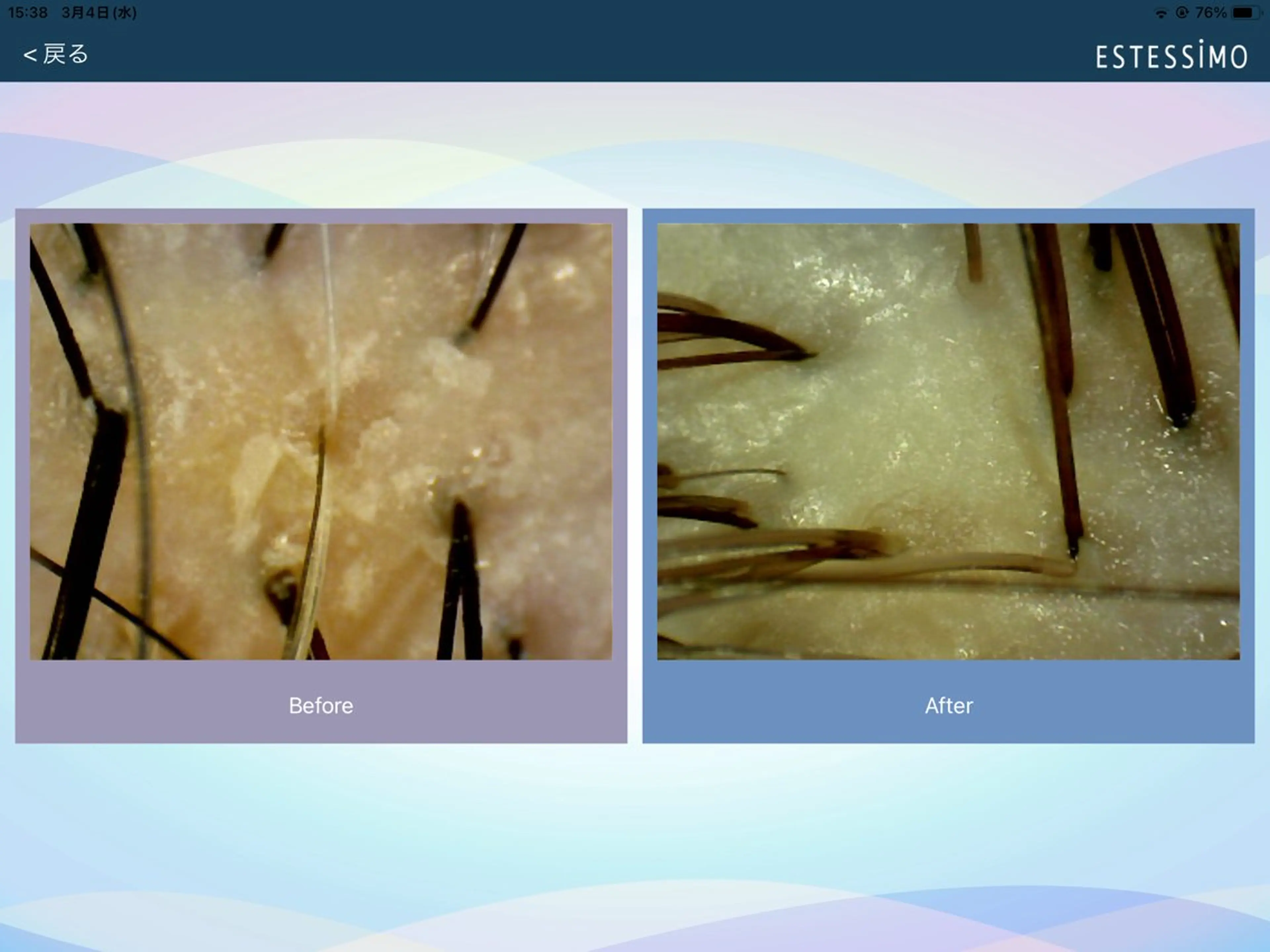 撮影モデル specials. 小室のその他イメージ