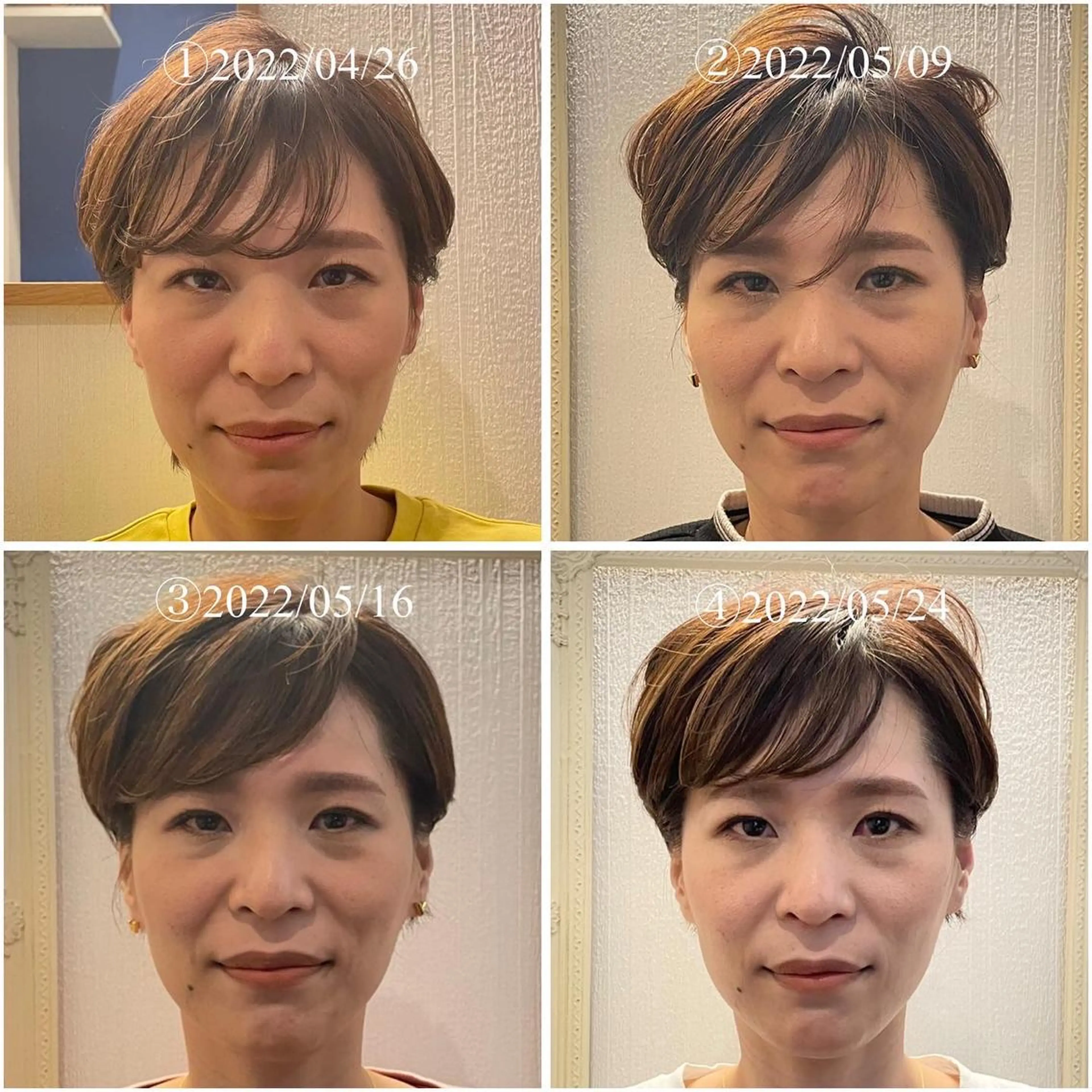 美容鍼　蒼月-aotsuki-所属・美容鍼「蒼月」 -アオツキ-のエステ・リラクイメージ