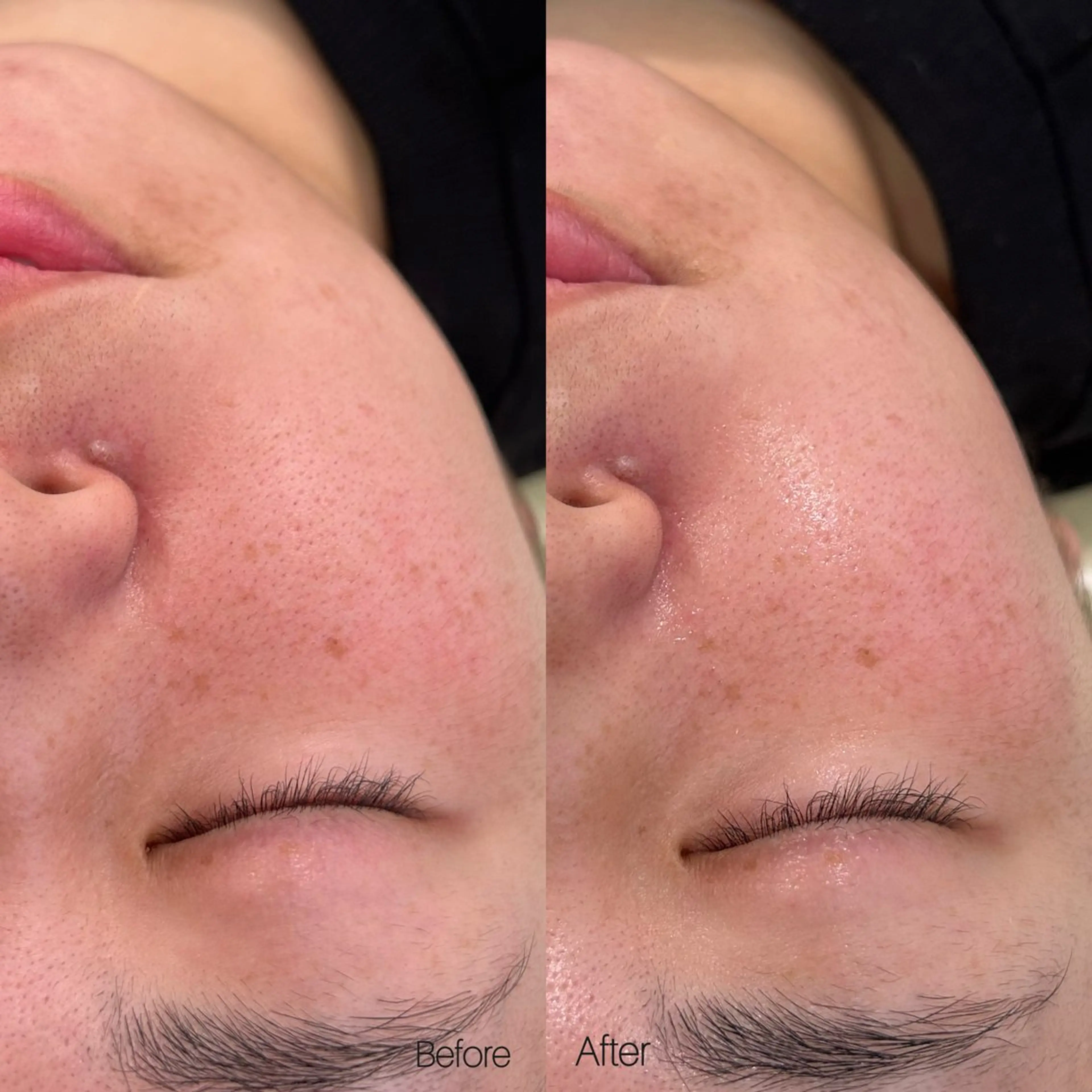 エステ 〈etre〉トータルビューティーサロン所属・etre - 韓国肌管理 -のエステ・リラクイメージ