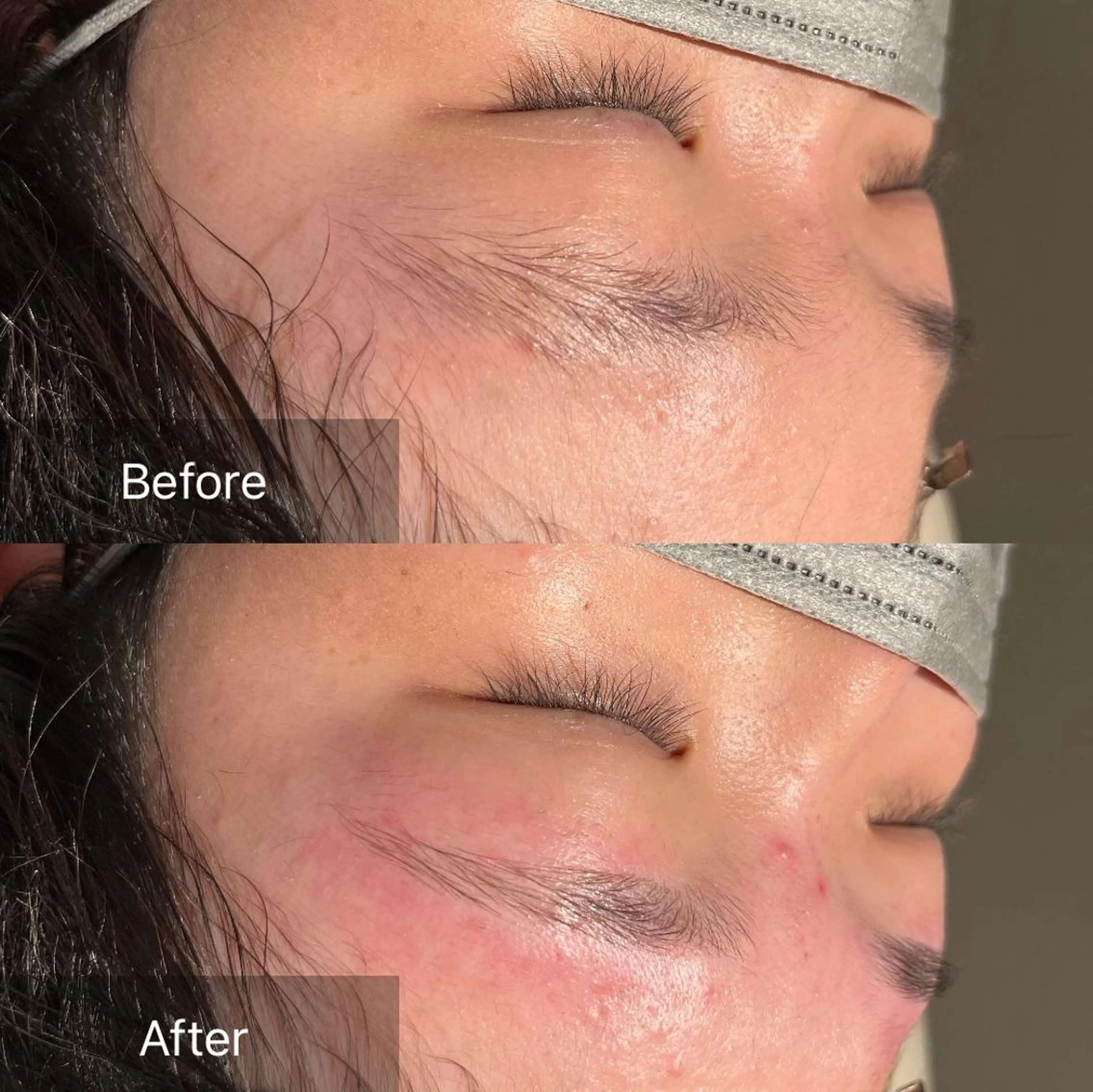 アイブロウ ワックス脱毛 眉カット その他(アイブロウ) for woman所属・森 美優のエステ・リラクイメージ