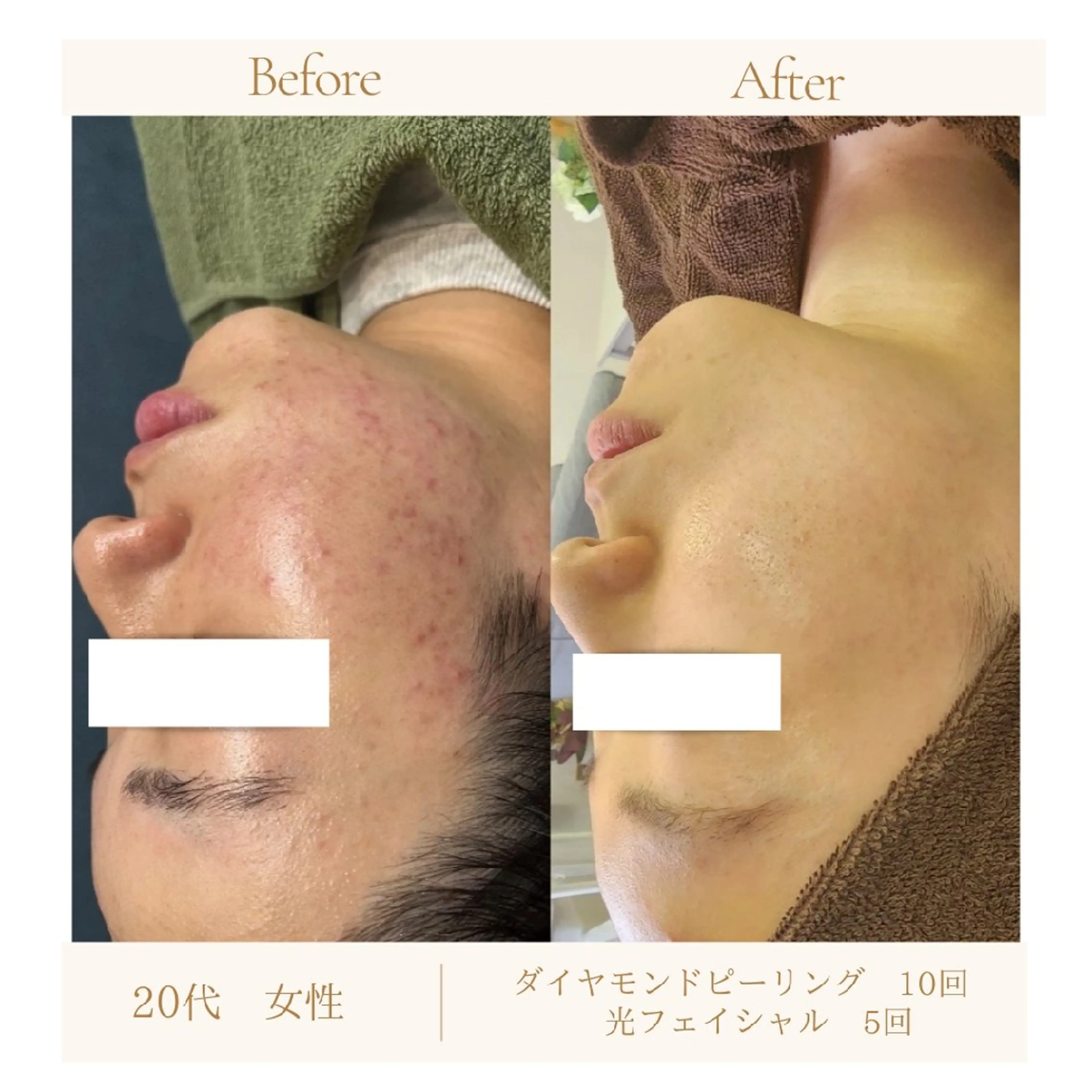 エステ ラヴィエベル 中嶋のエステ・リラクイメージ