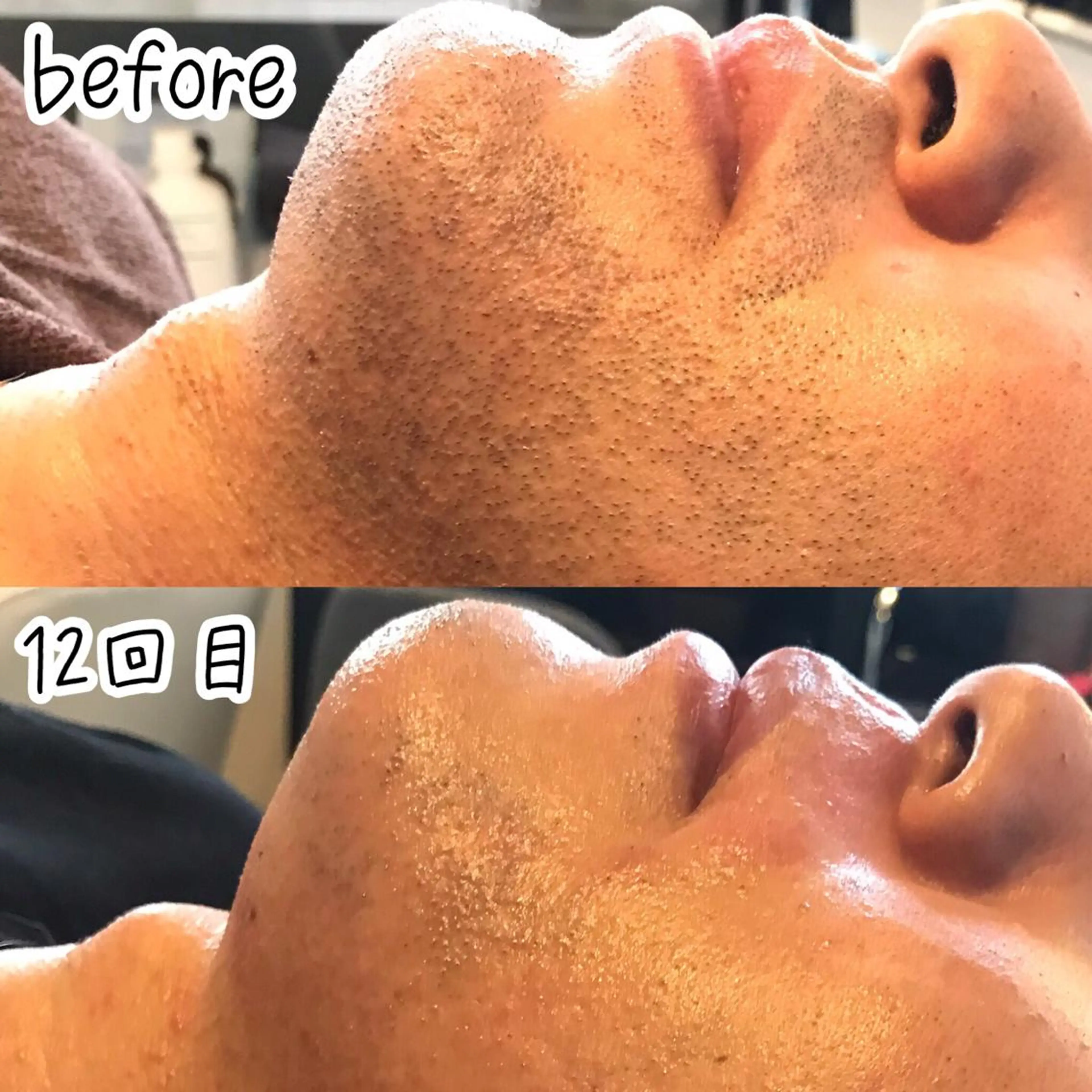 脱毛 浜野 恵美のエステ・リラクイメージ