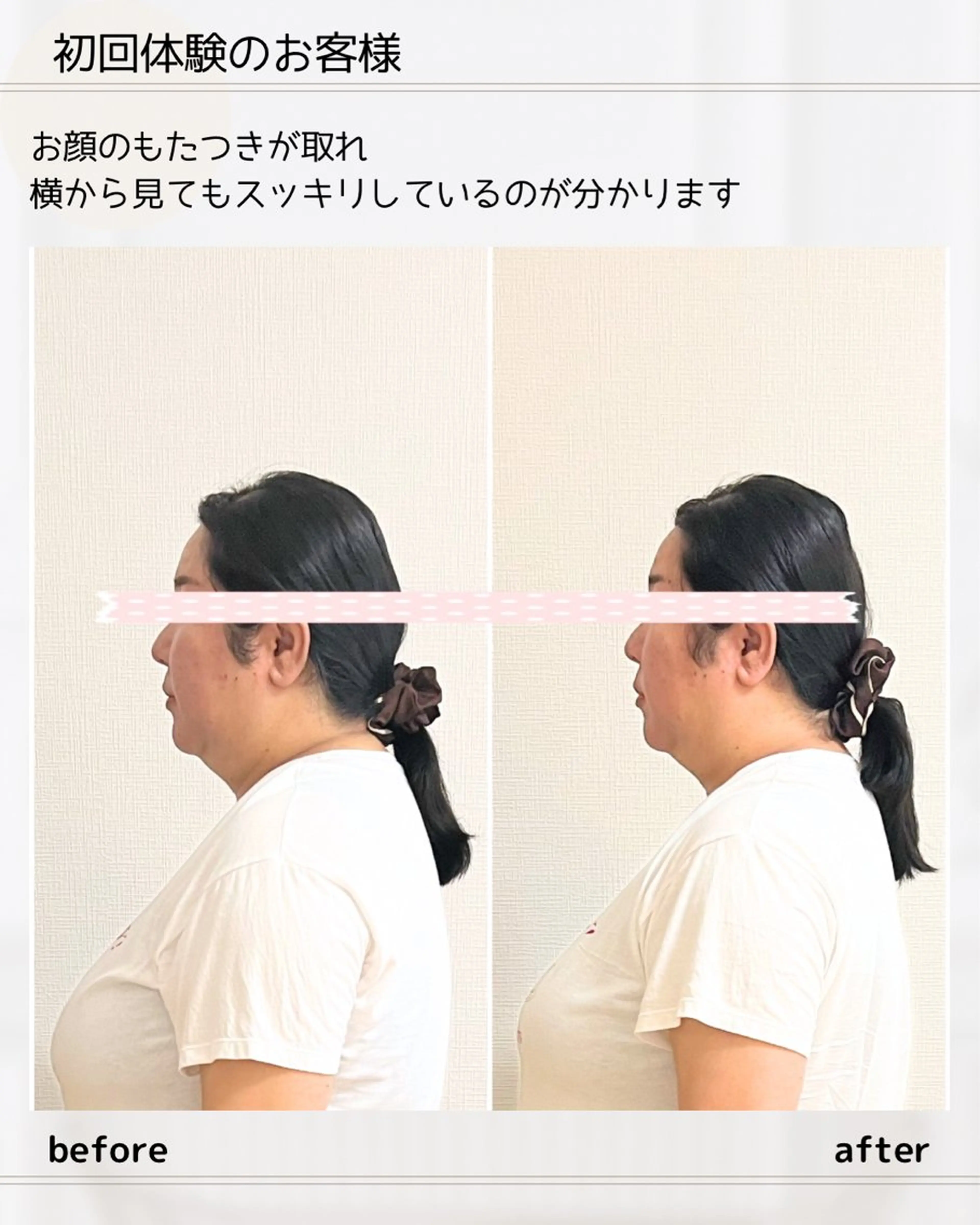 小顔矯正& 慢性肩こり腰痛改善店のエステ・リラクイメージ