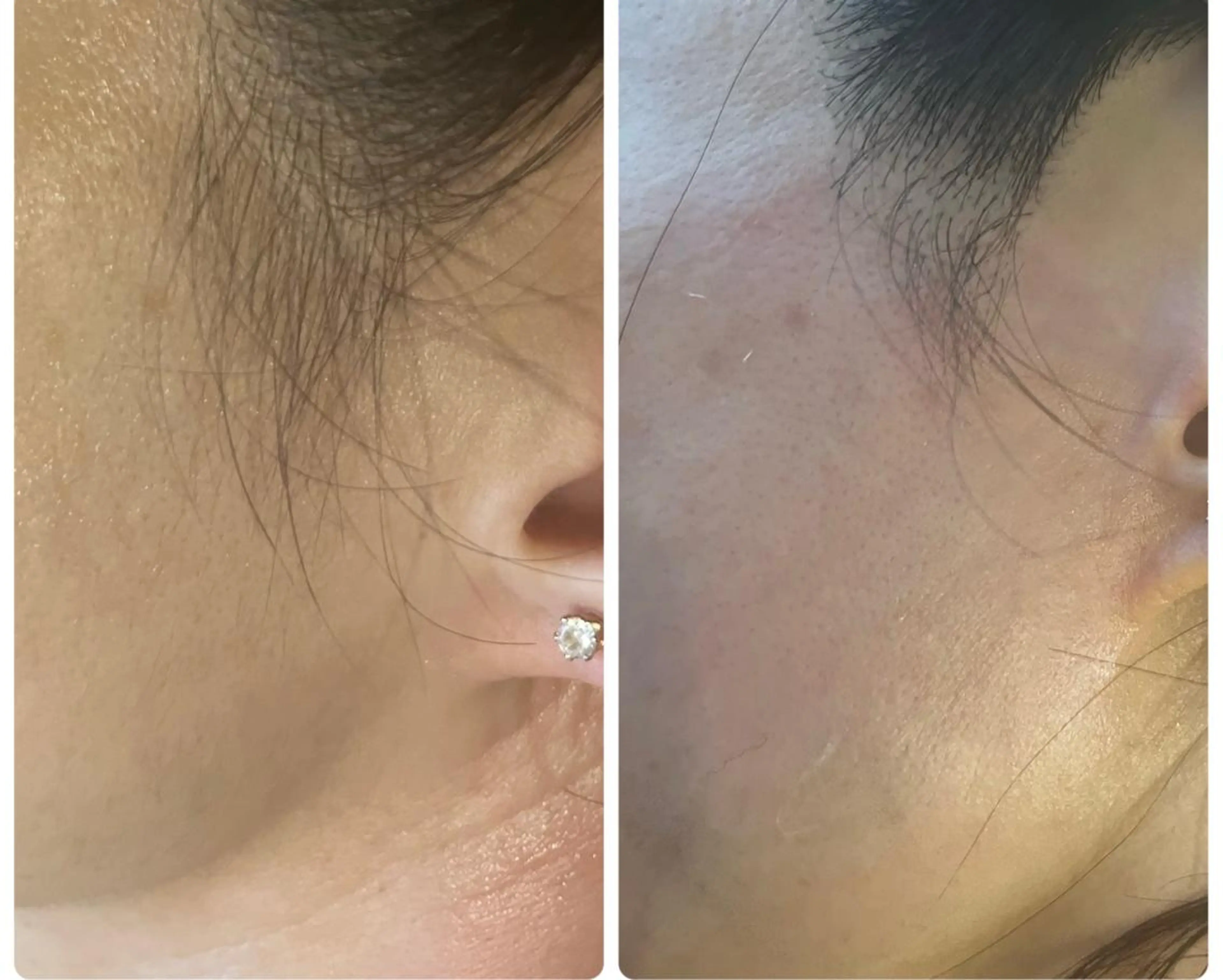 Nail & 高速脱毛 avenir【アヴニール】所属・WAX/眉/光脱毛 🌿リラク/小顔のエステ・リラクイメージ