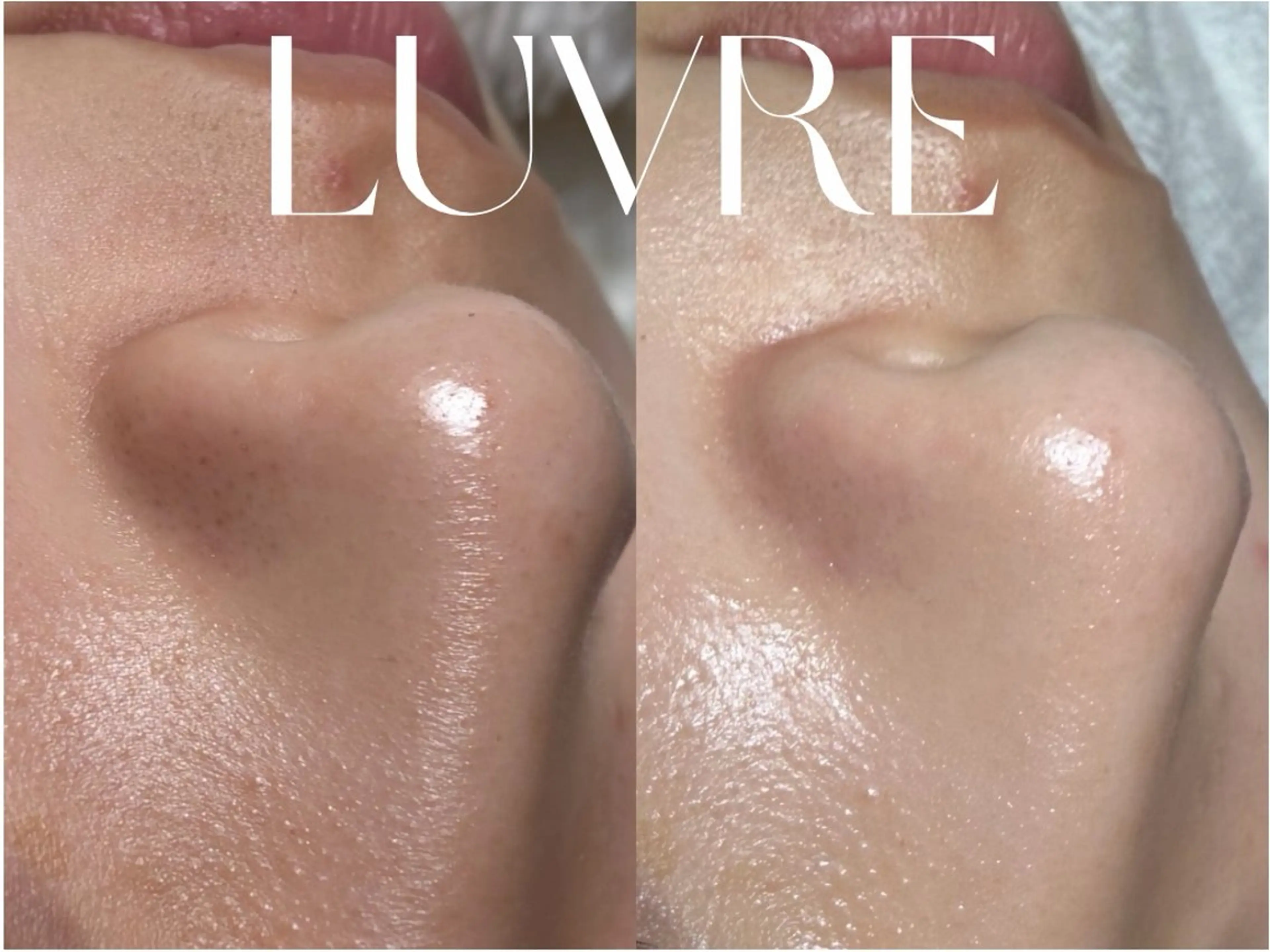 LUVRE/北区 龍田/MIKIのエステ・リラクイメージ