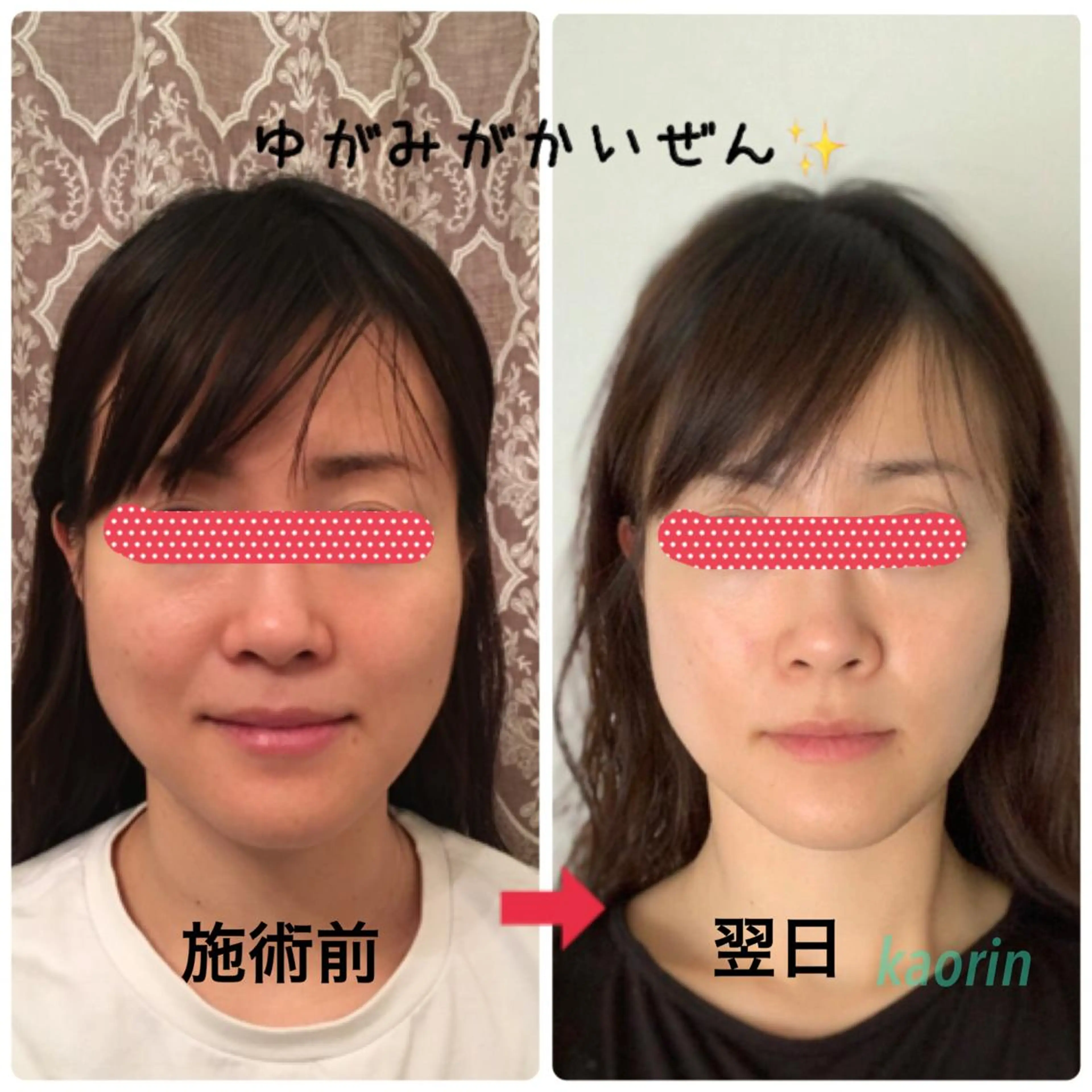 小顔矯正サロン顔凛 KANAのエステ・リラクイメージ