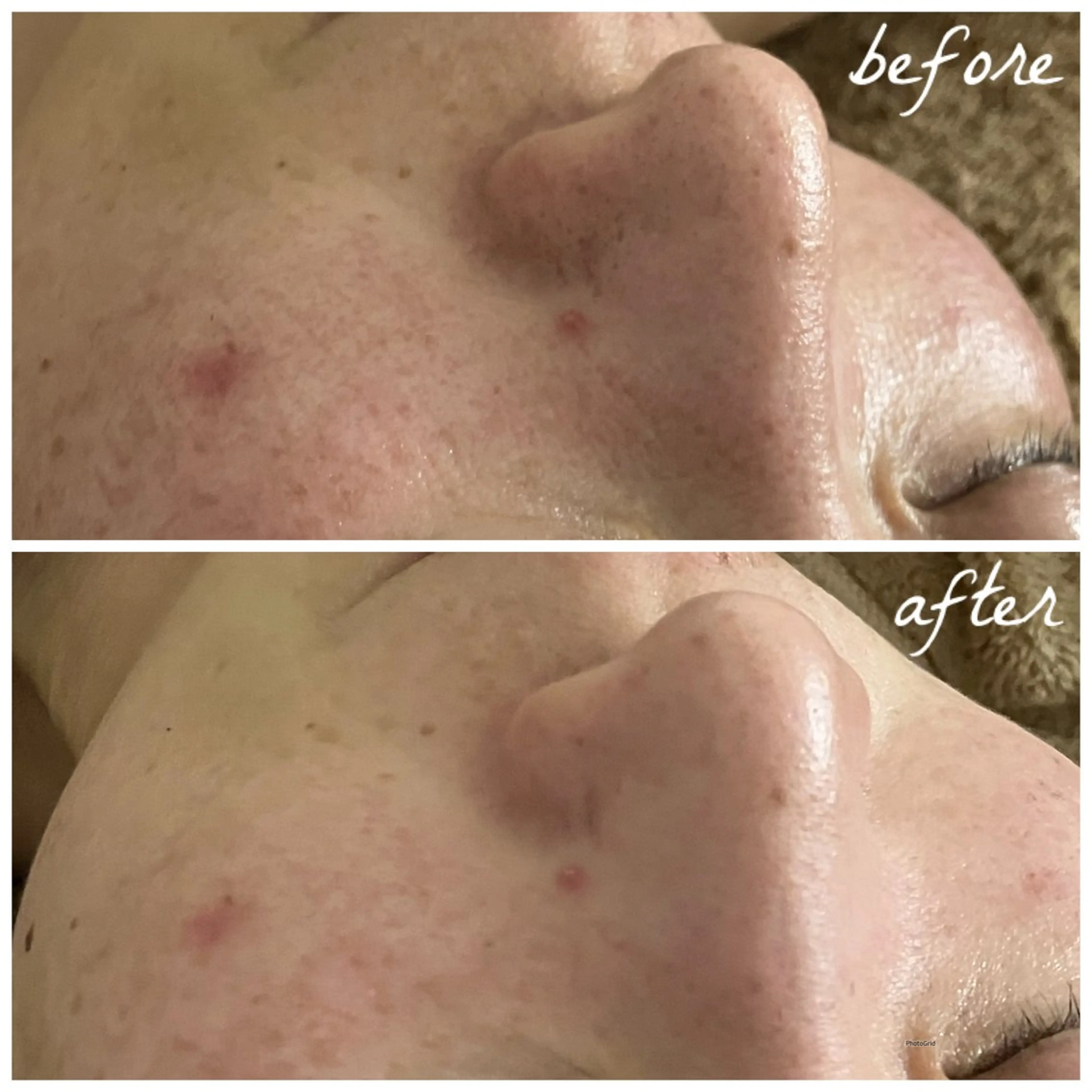 メンズ エステ メナード岐阜茜部 杉浦のエステ・リラクイメージ