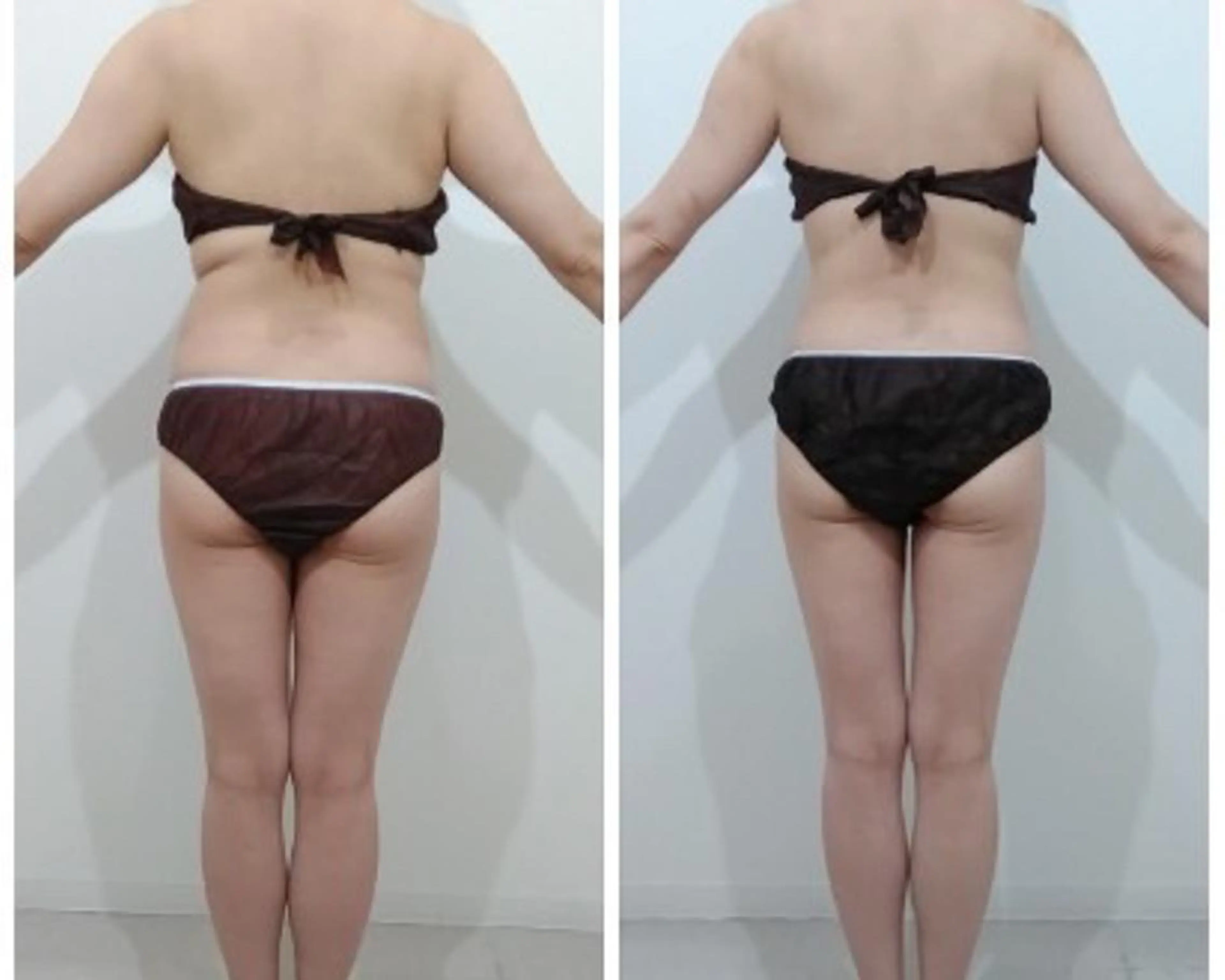 秒速小顔  恵比寿店所属・秒速小顔 恵比寿店 店長 さきのエステ・リラクイメージ