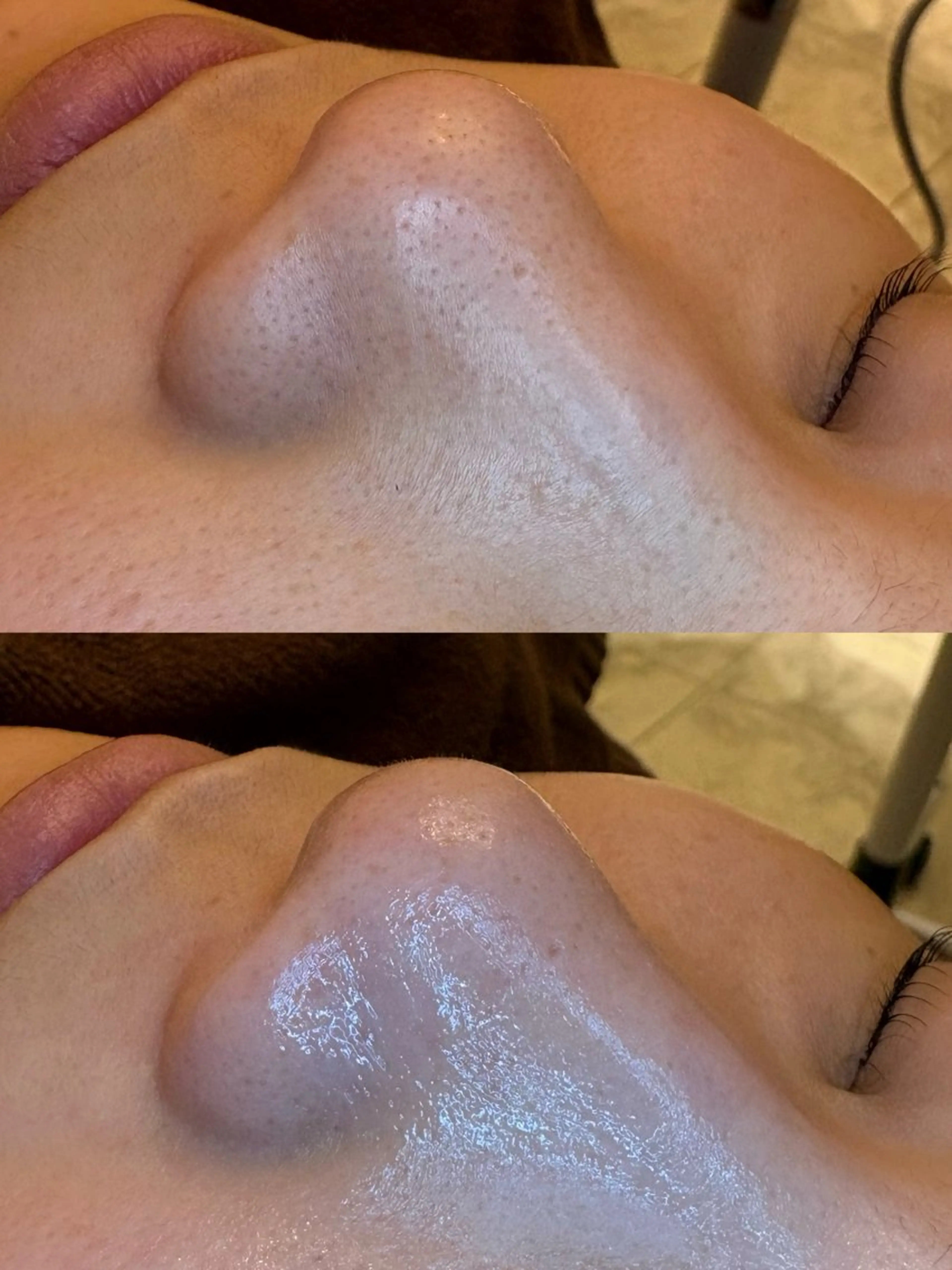 エステ EARTH coiffure beaute 新潟紫竹山店所属・🤍アベシュリ /フェイシャル🤍のエステ・リラクイメージ