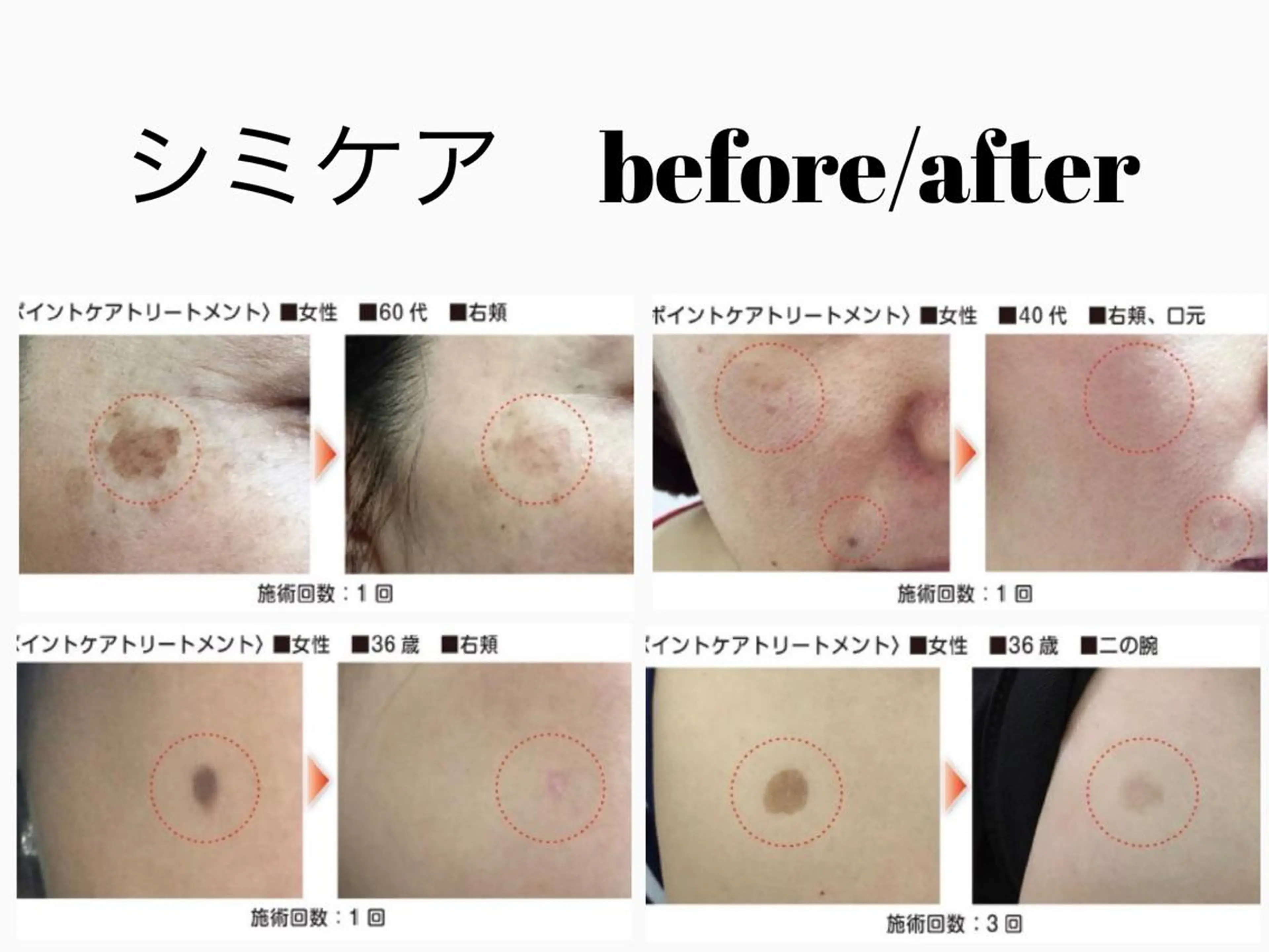 リオッサ  オブ ラグーン神戸店のエステ・リラクイメージ