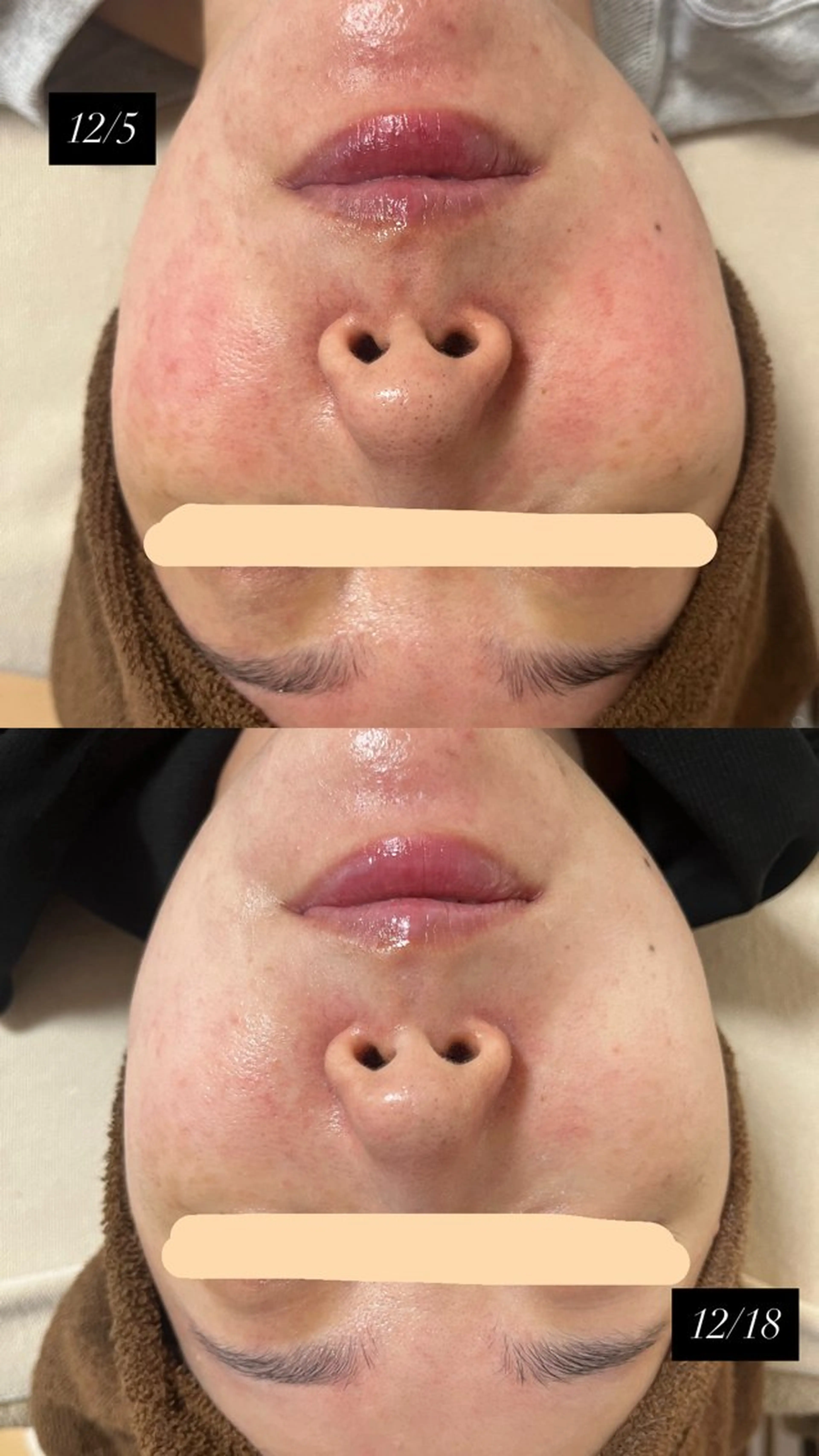 エステ salon More所属・出口 玲菜のエステ・リラクイメージ