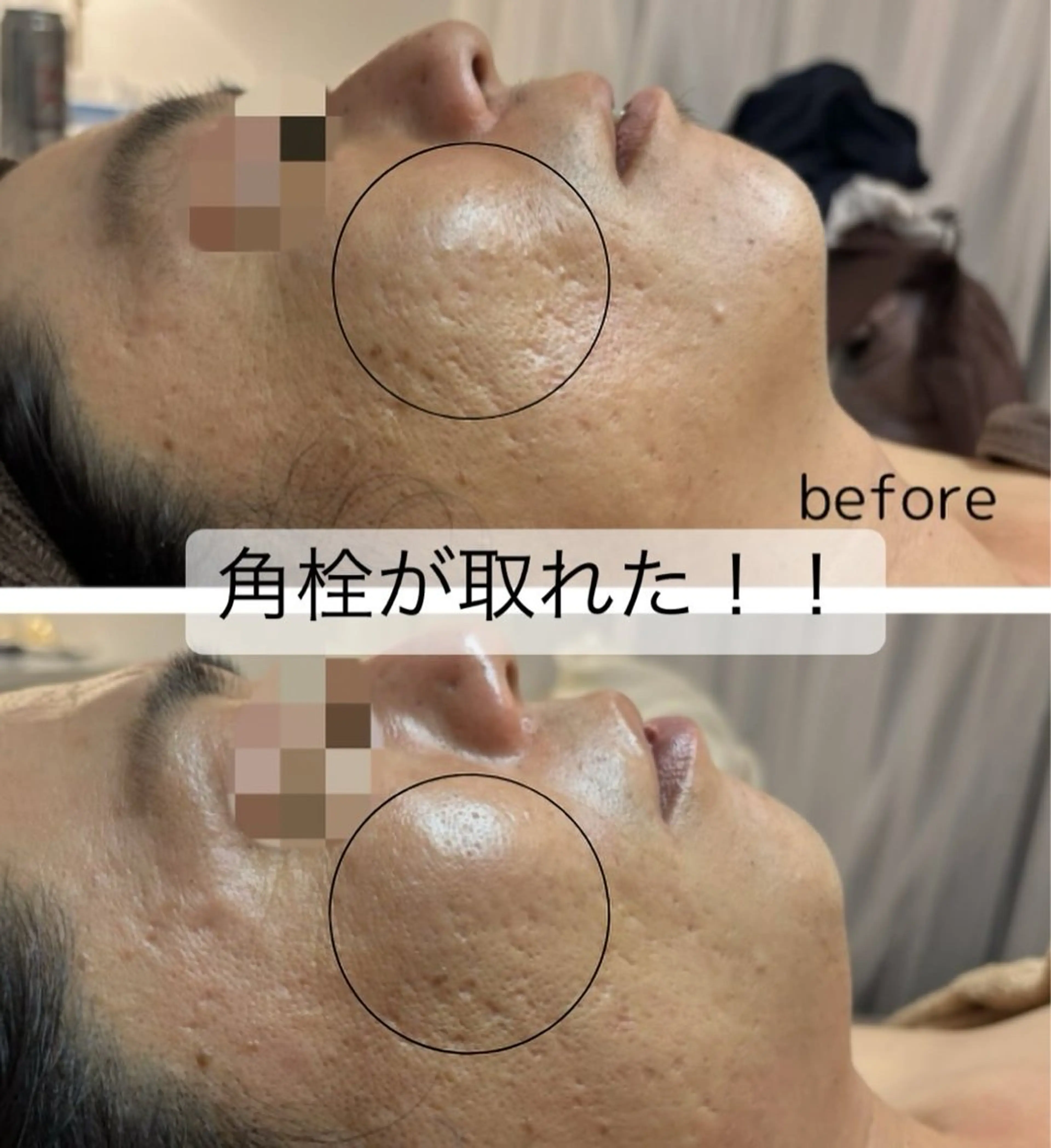 エステ 肌質改善フェイシャルCLEAR栄生/リンパ/毛穴/シミケア所属・井戸 麻衣のエステ・リラクイメージ