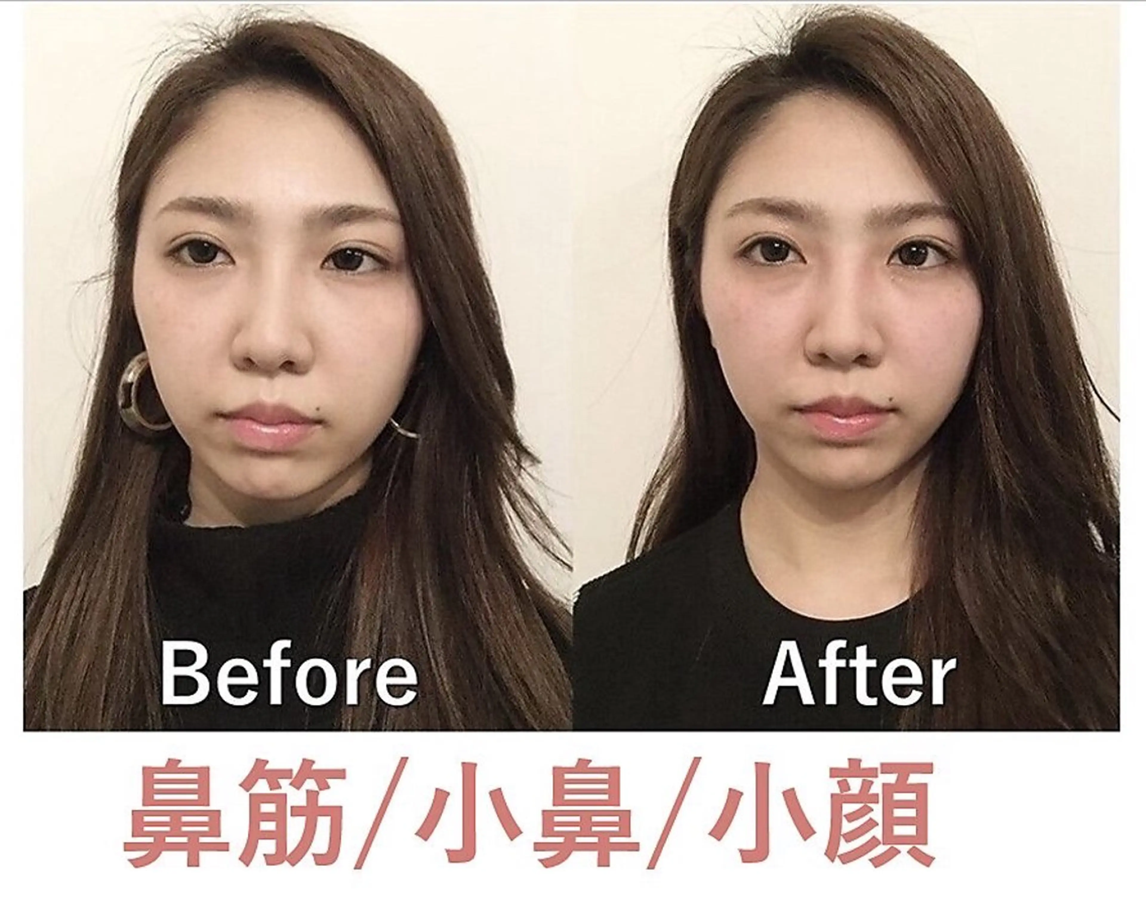 美鼻&小顔専門店 ラプリ　毛井のエステ・リラクイメージ