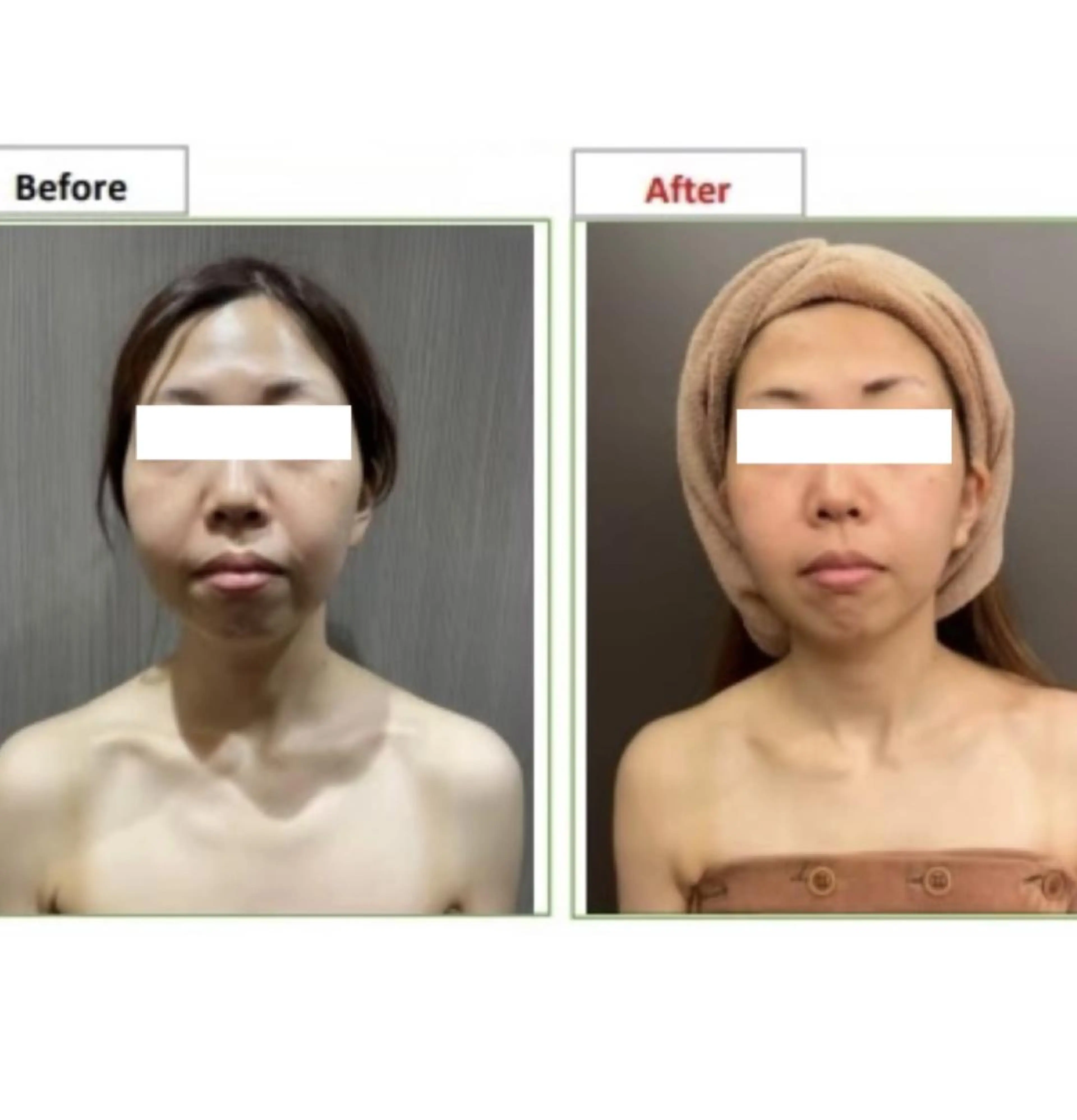 エステ レイビス 渋谷店🤍のエステ・リラクイメージ