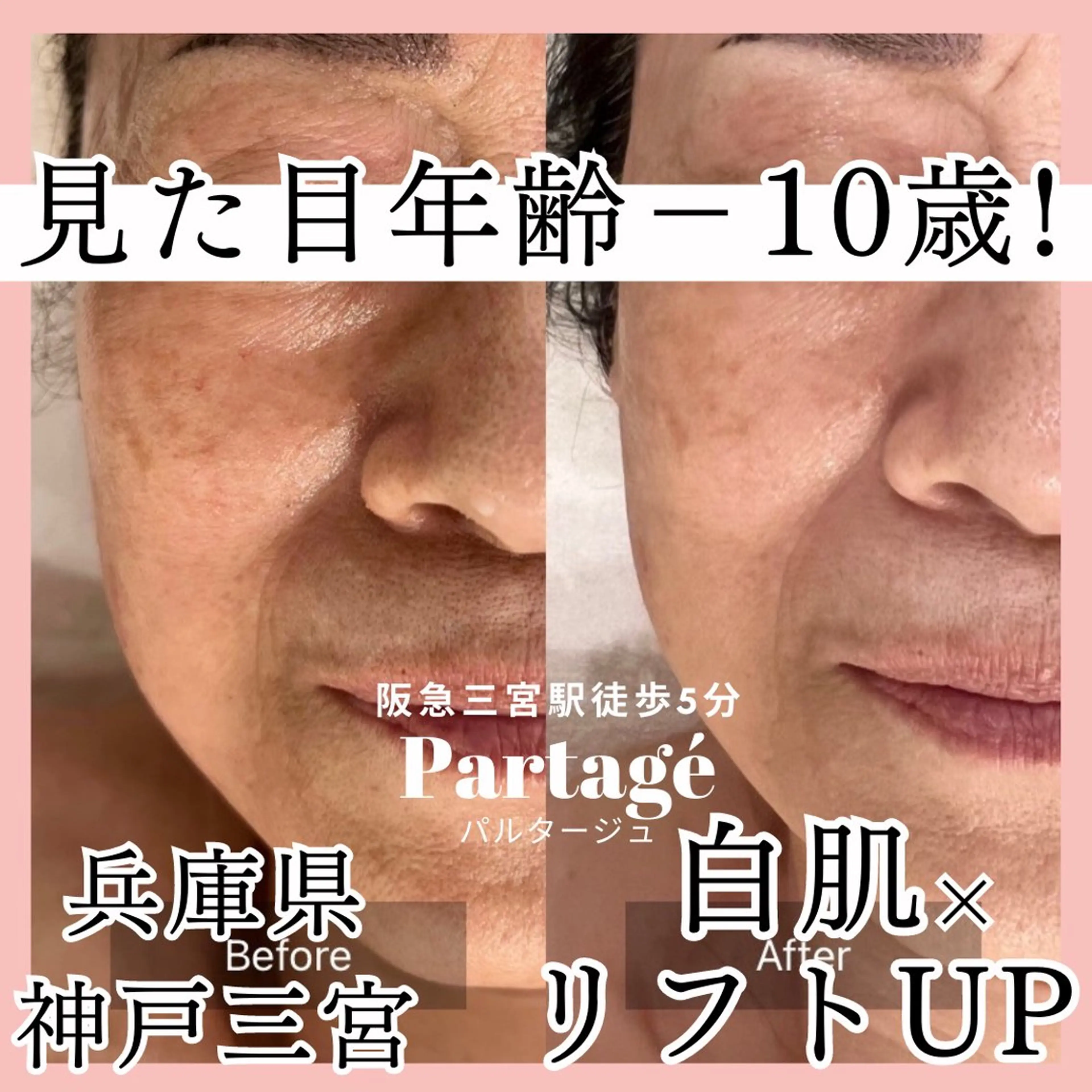 エステティックサロンPartagé【パルタージュ】所属・小尻・太もも痩せる パルタージュのエステ・リラクイメージ