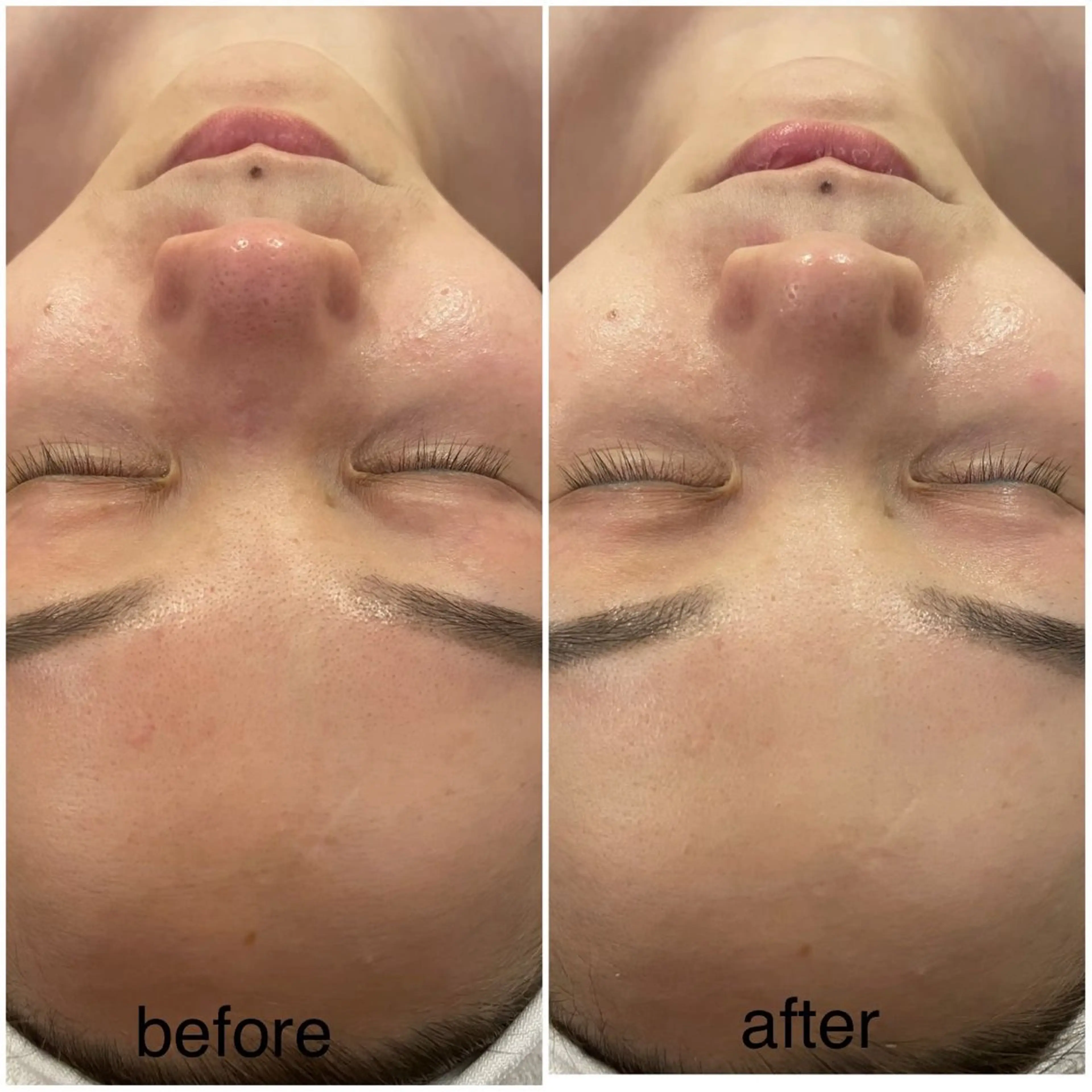 L'amour 御徒町所属・L'amour御徒町 🎀MoMo🎀のエステ・リラクイメージ