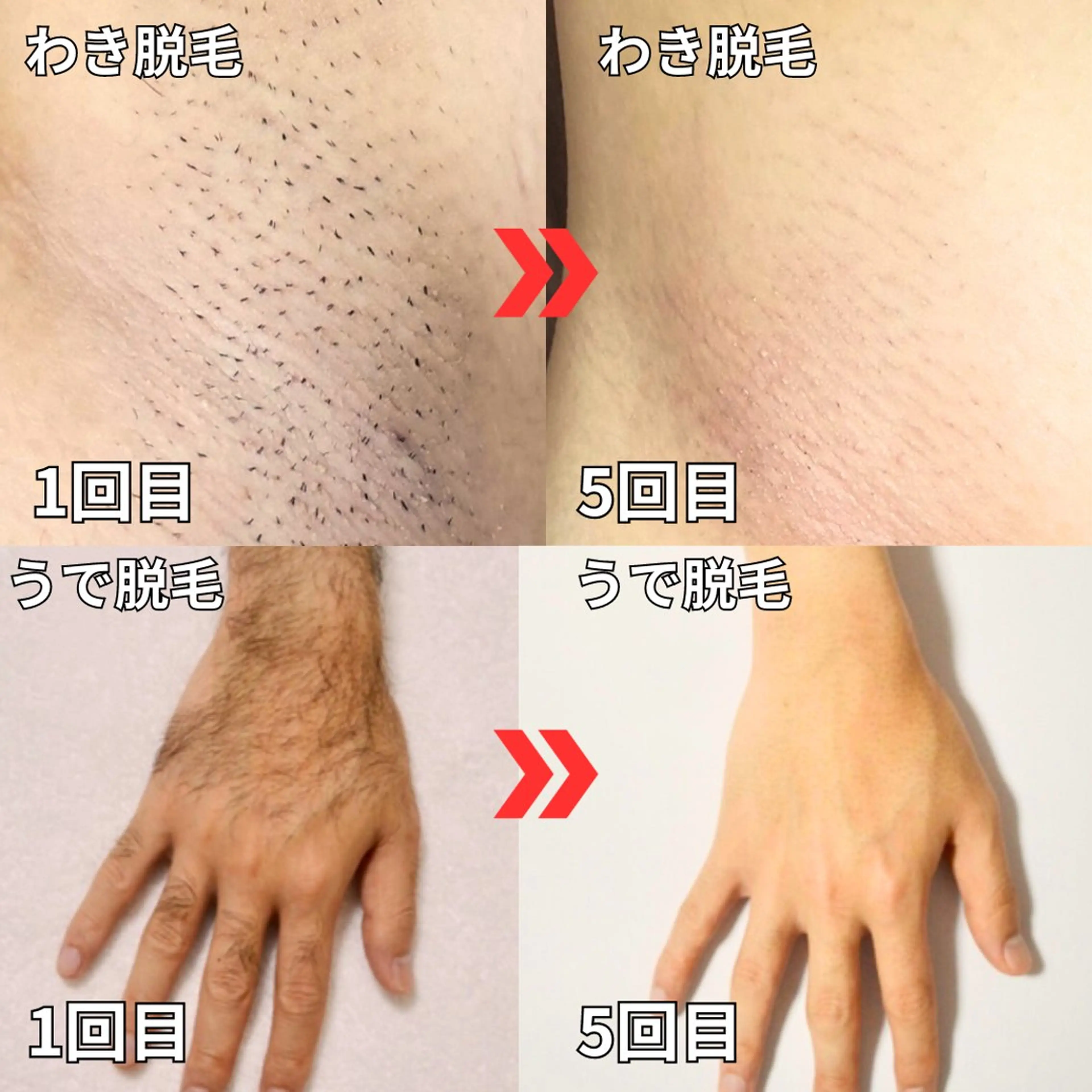 メンズ 【メンズ脱毛専門店】TODAY所属・都度払い制メンズ脱毛 オーナーのエステ・リラクイメージ