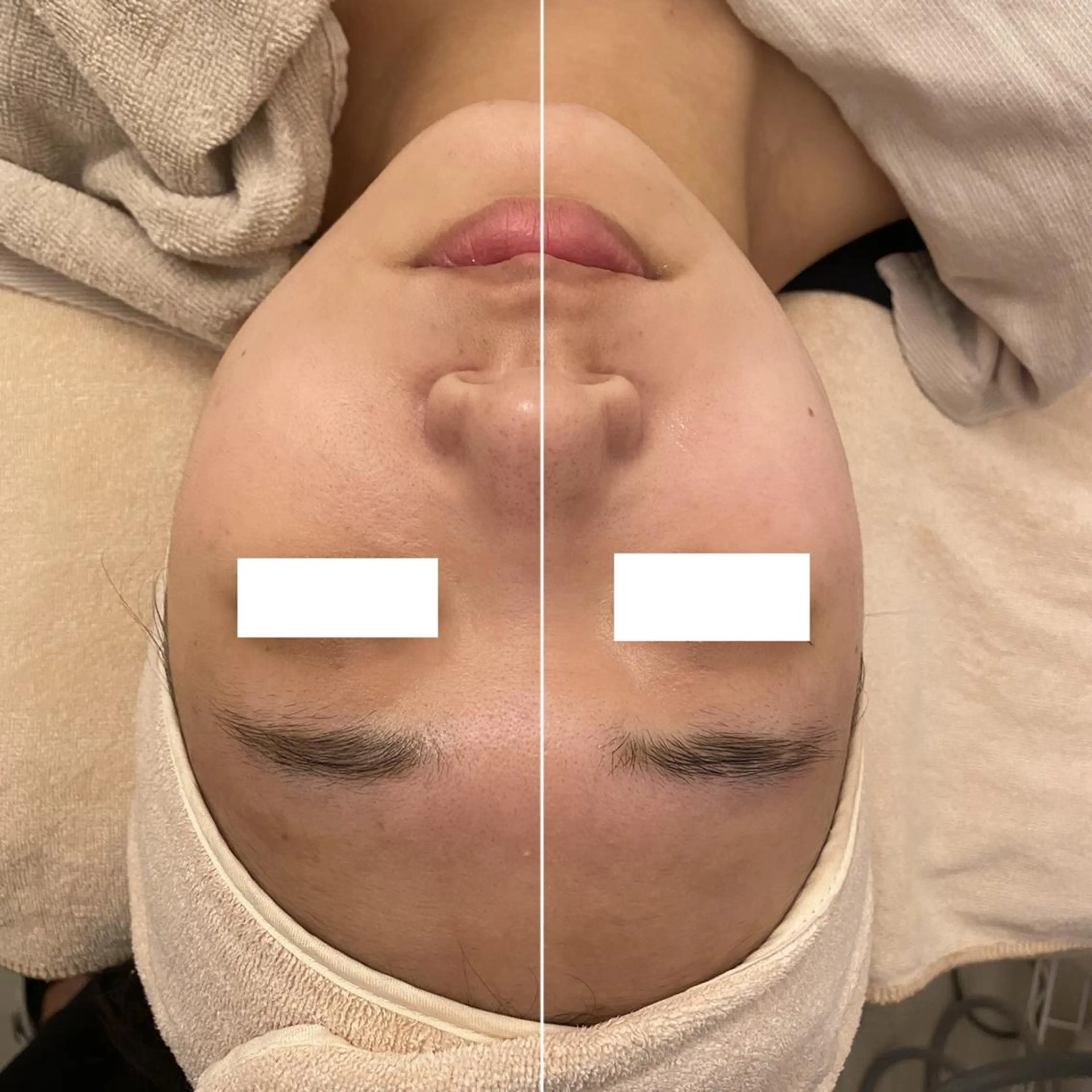 ✨美肌水光✨ アトリエリュバンのエステ・リラクイメージ