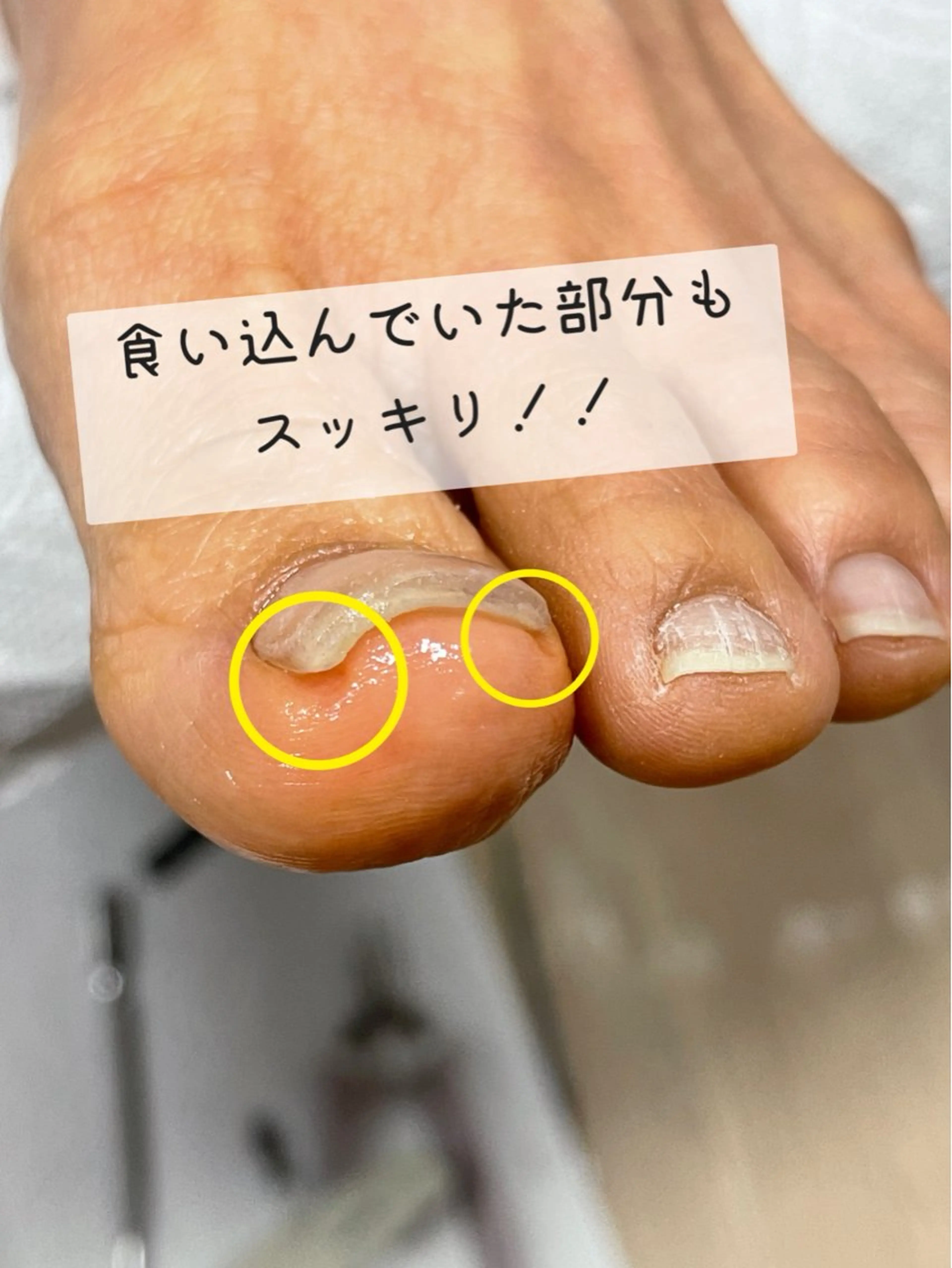 メンズ ネイル Chérinail 爪のお手入れのネイルデザイン