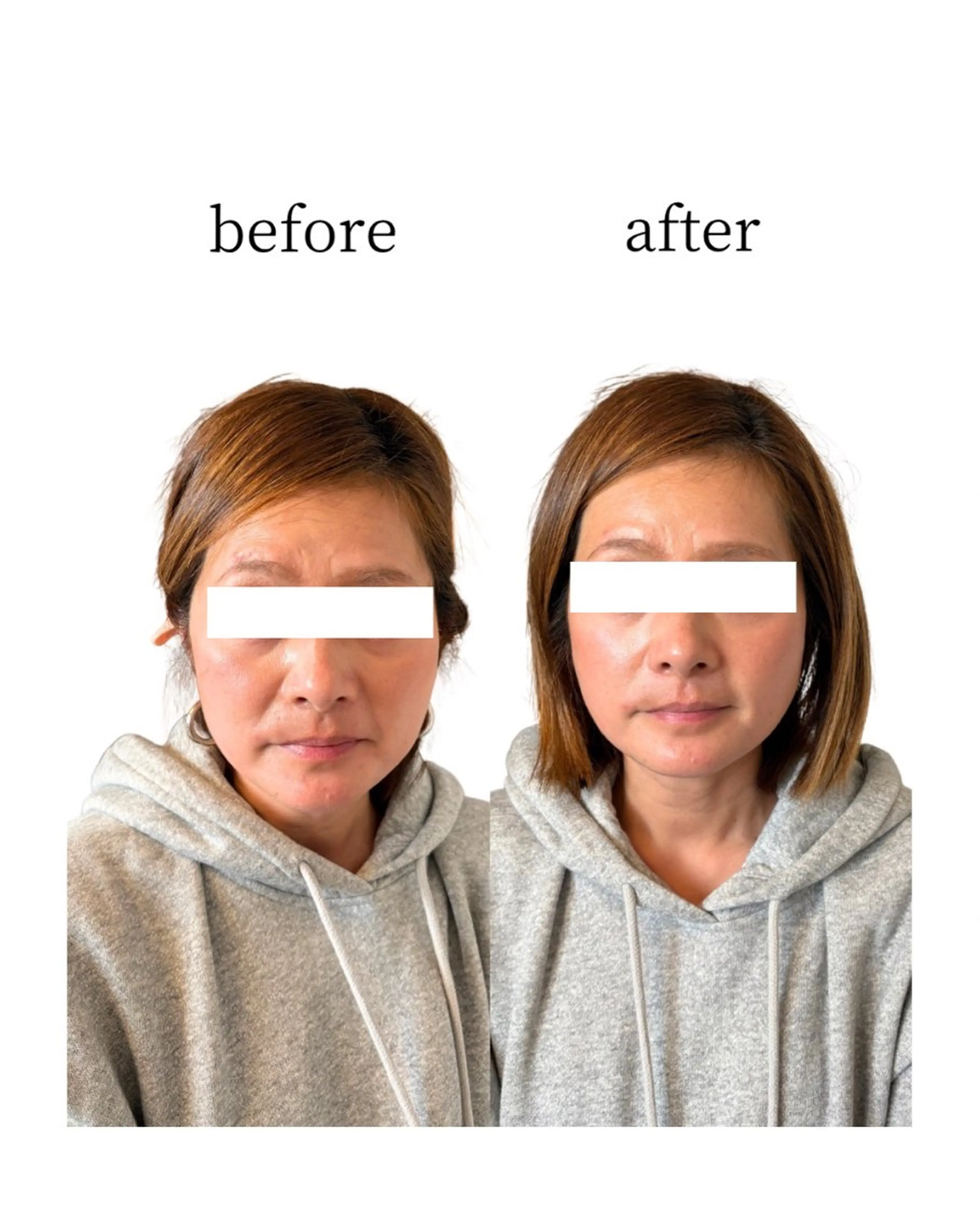 その他 Noelie所属・平野 育美のその他イメージ