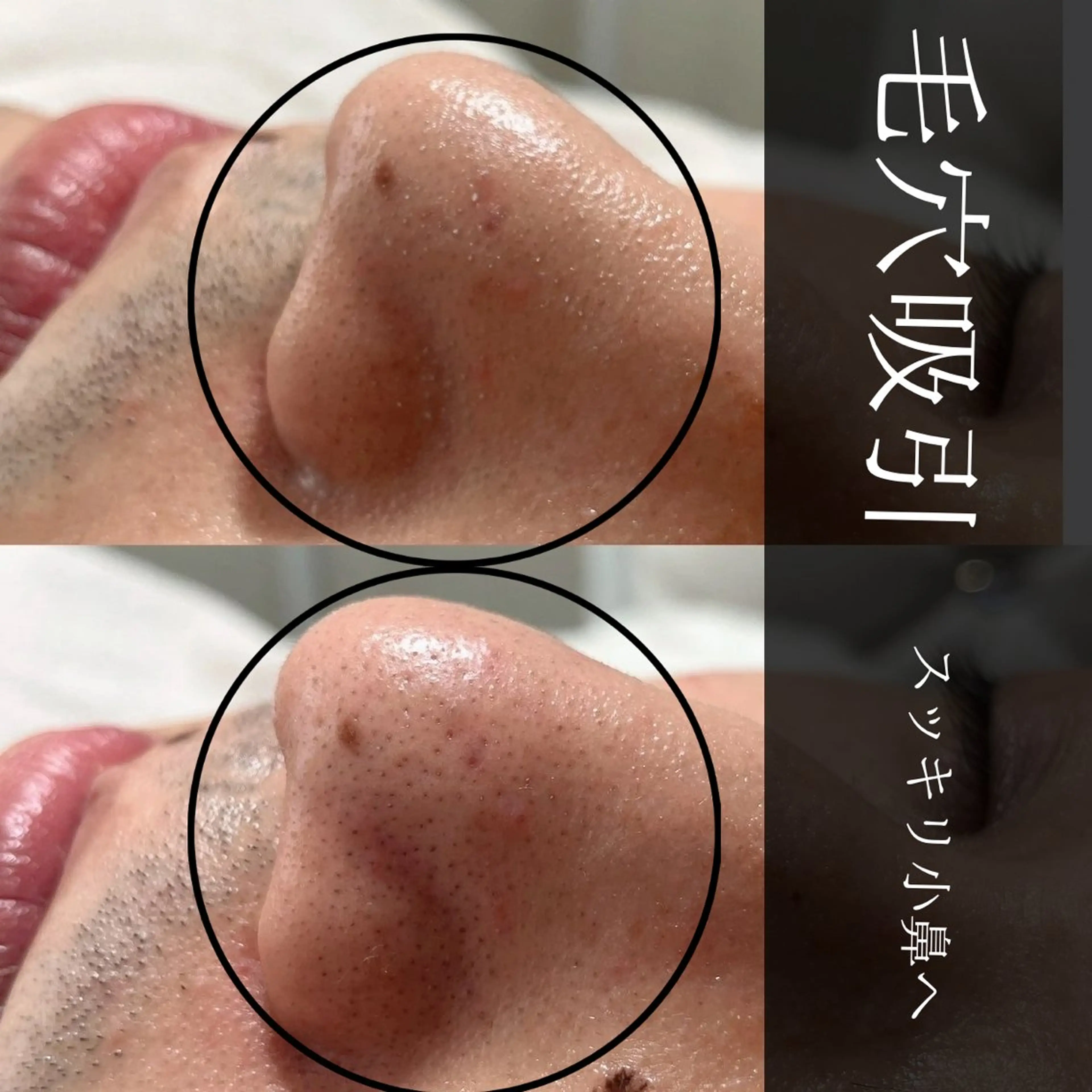 yokohama 🎀miaのマツエク・マツパデザイン