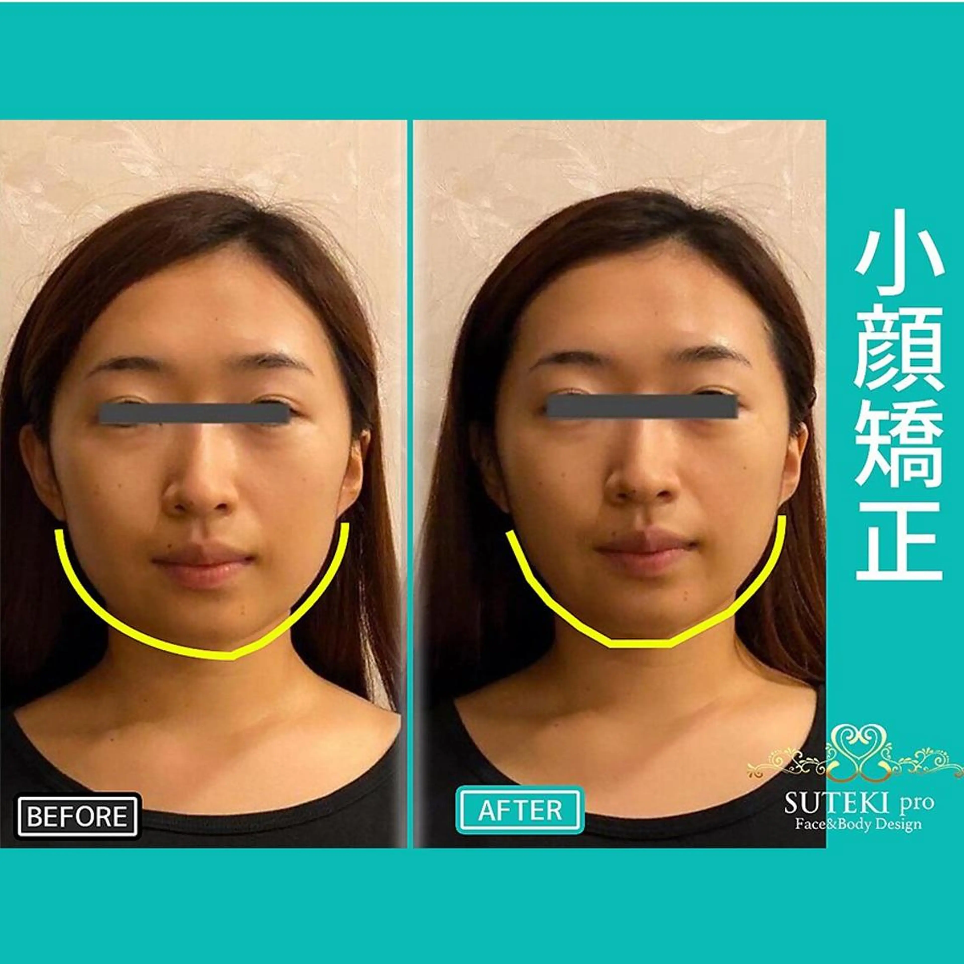 姿勢・骨盤/小顔矯正 痩身ダイエット 横田のエステ・リラクイメージ