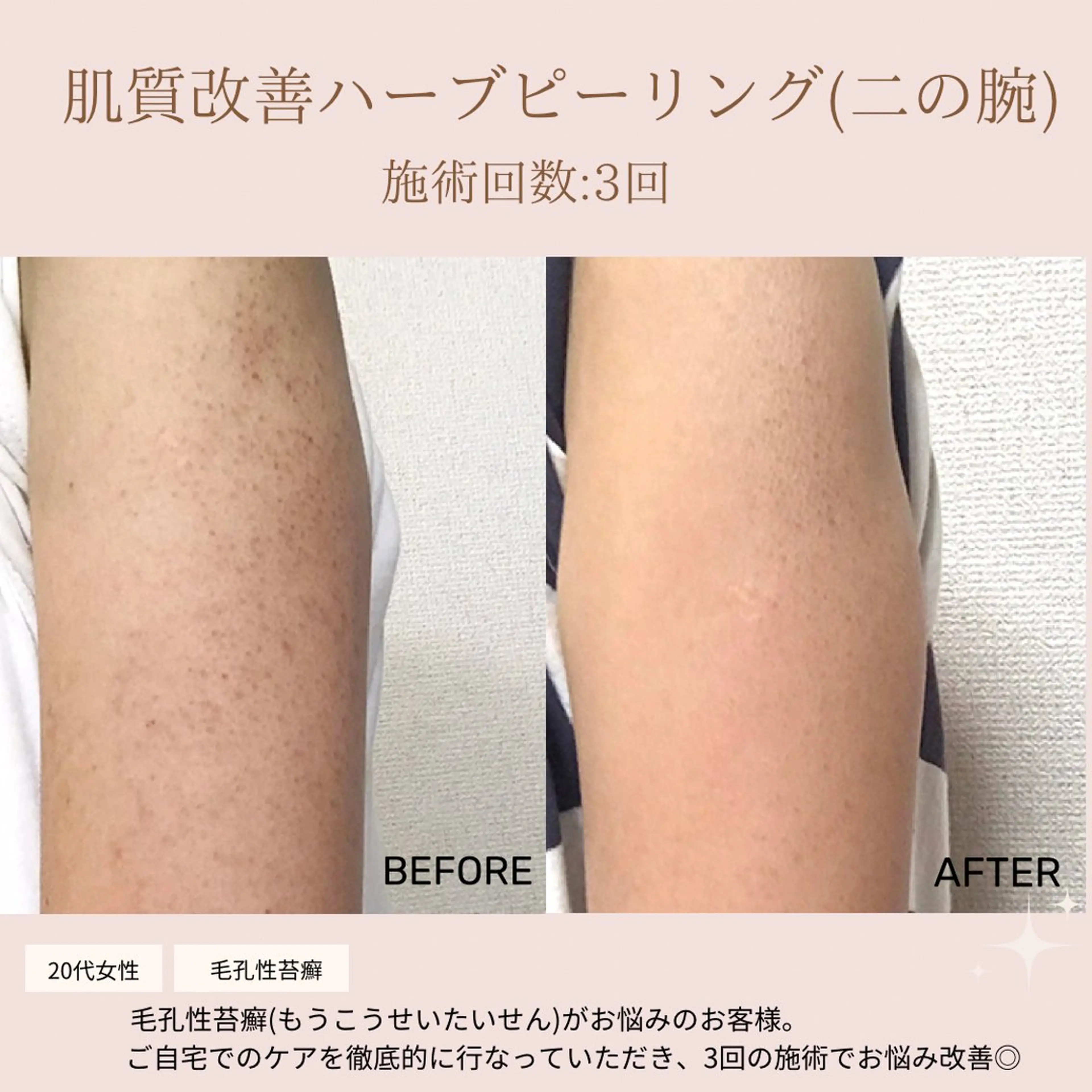 肌質改善専門サロン Bellmi/心斎橋のエステ・リラクイメージ