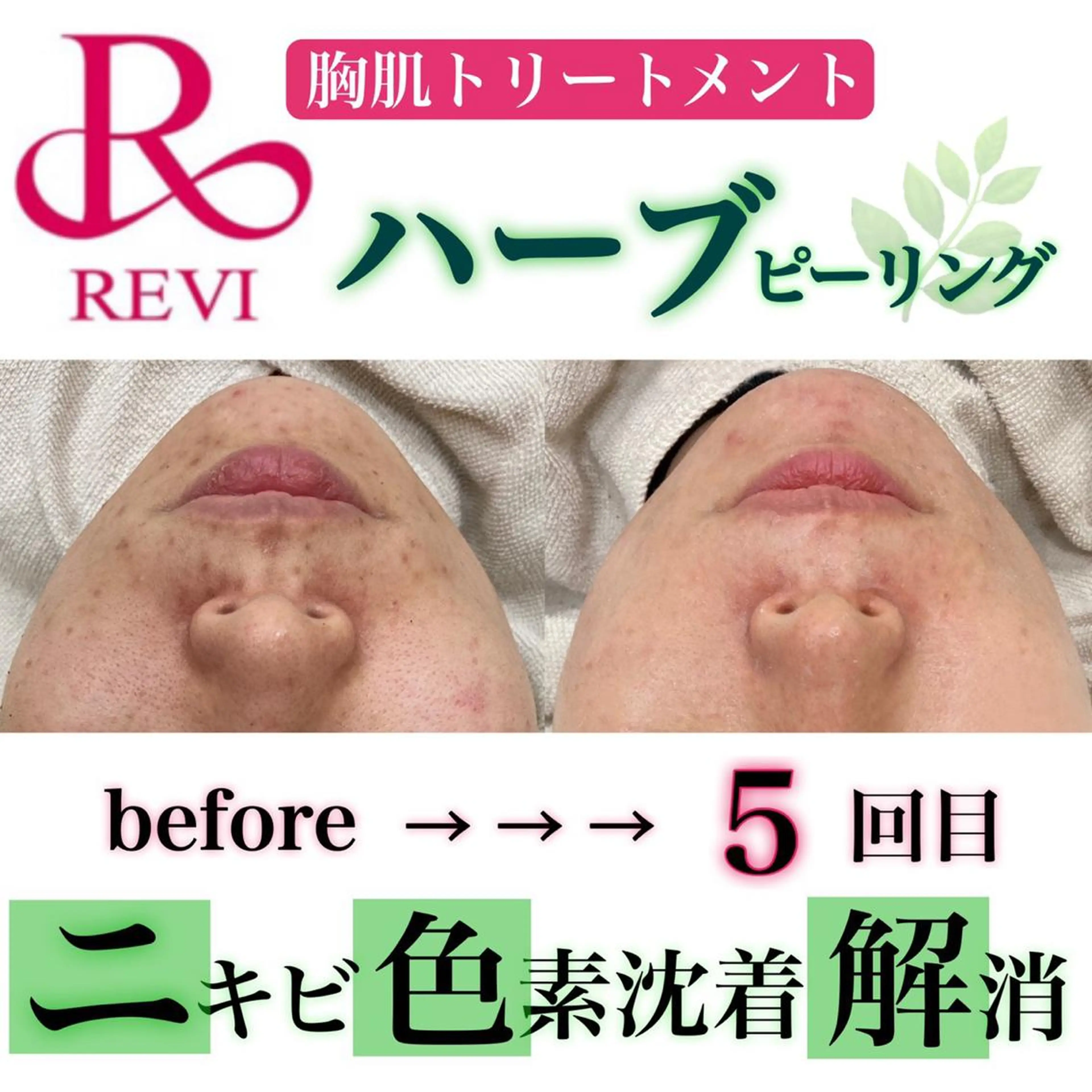 laluna saki...のその他イメージ