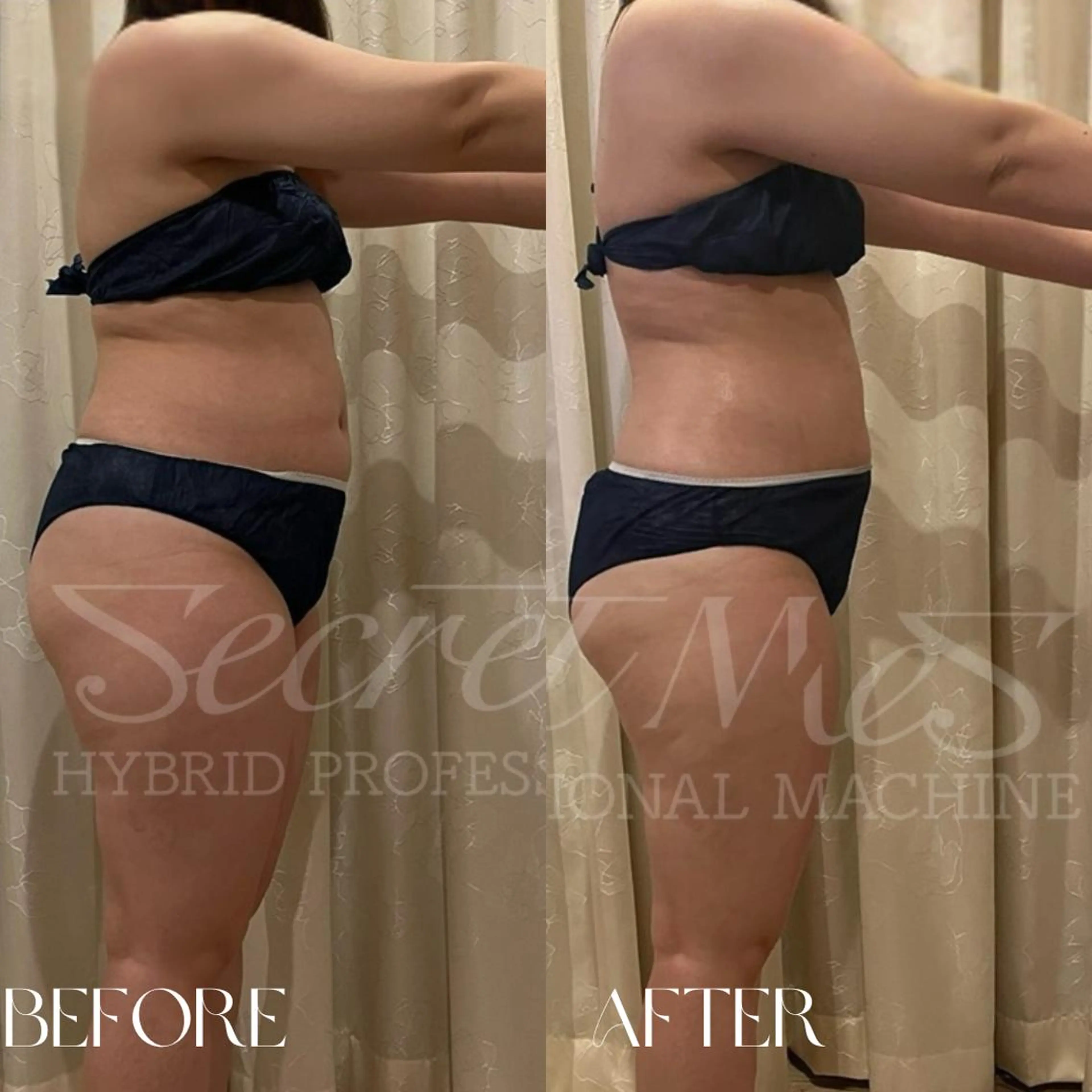 B-st. 下北沢のエステ・リラクイメージ