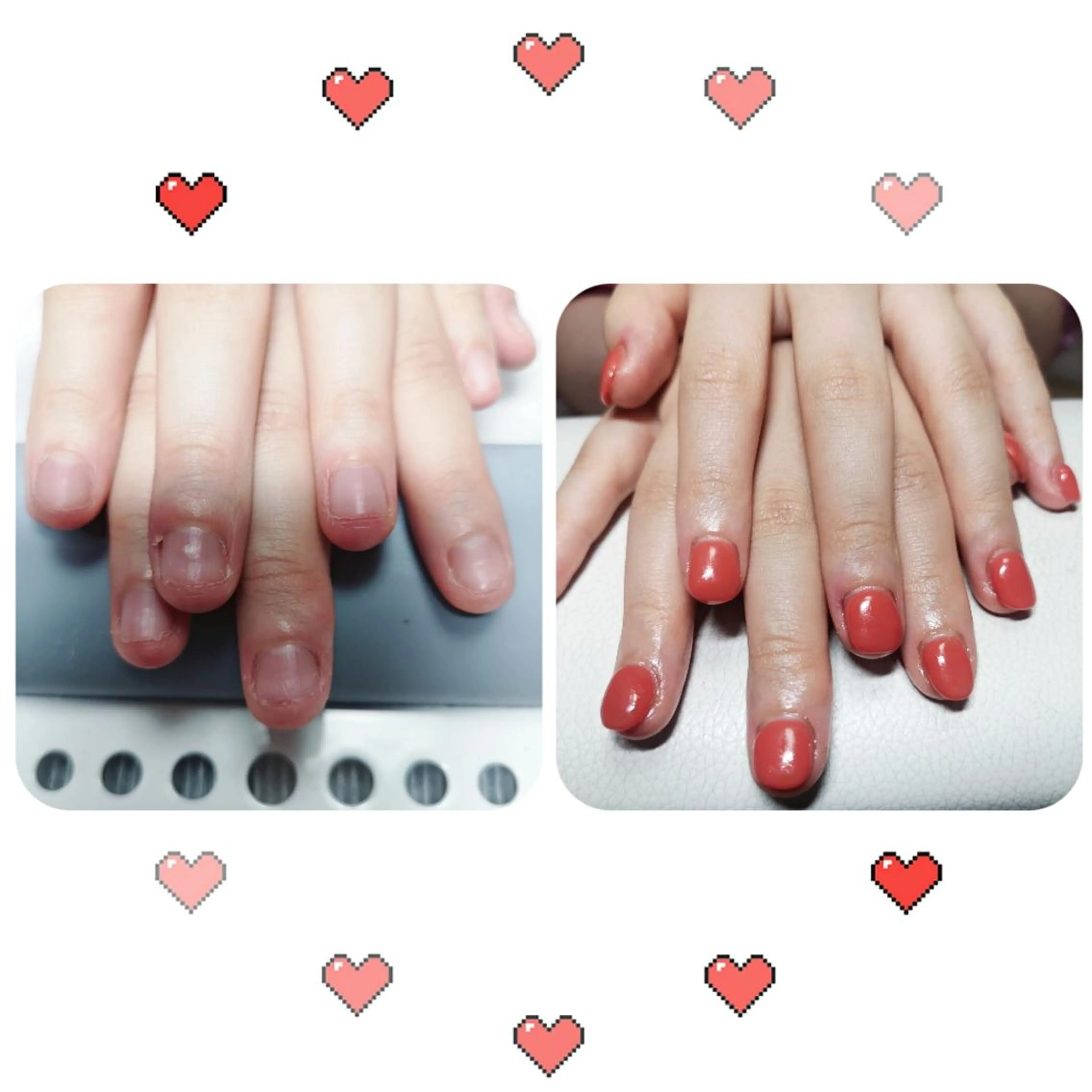 ネイル ショート ネイリストゆか💅 長さだし、深爪矯正のネイルデザイン