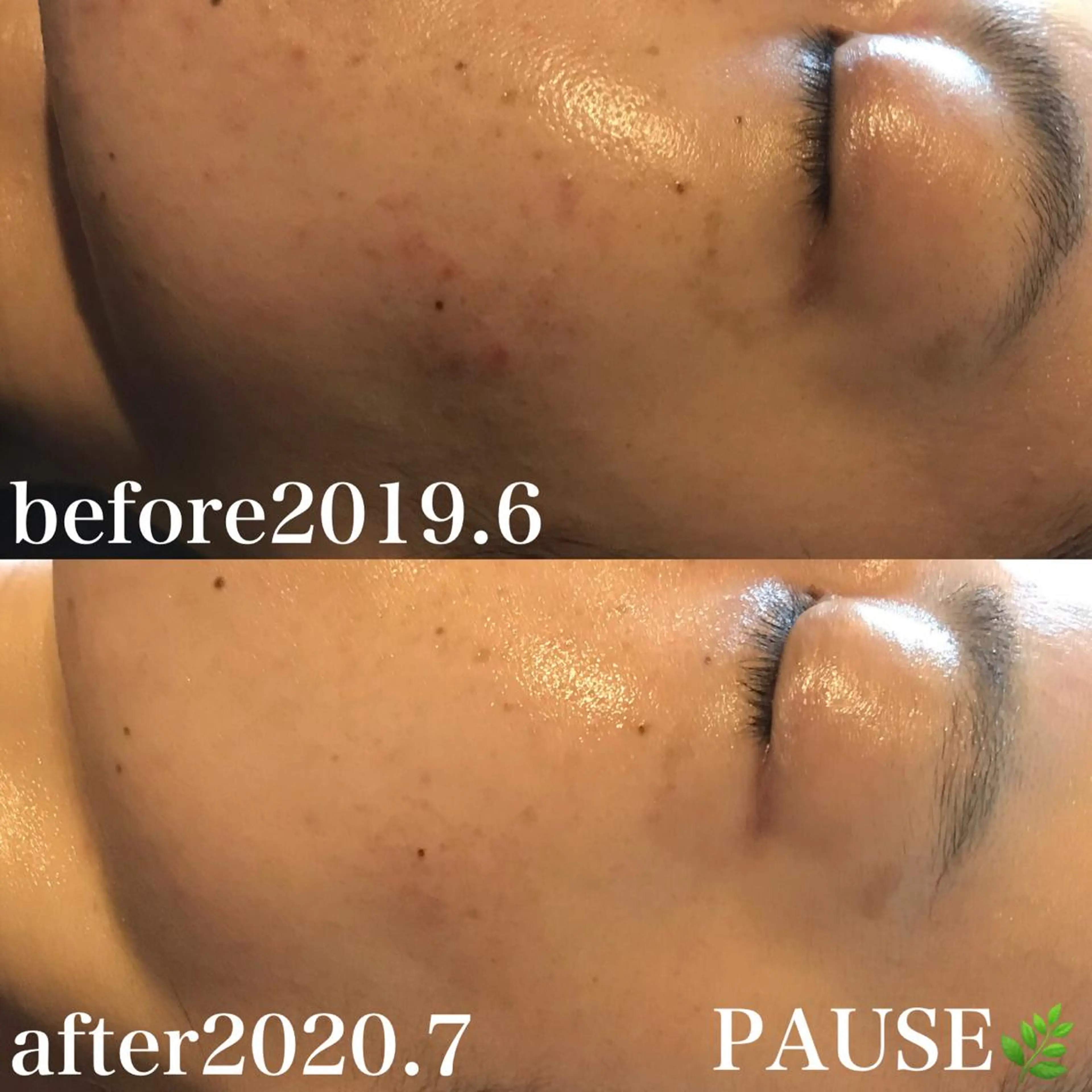 エステ 浜野 恵美のエステ・リラクイメージ