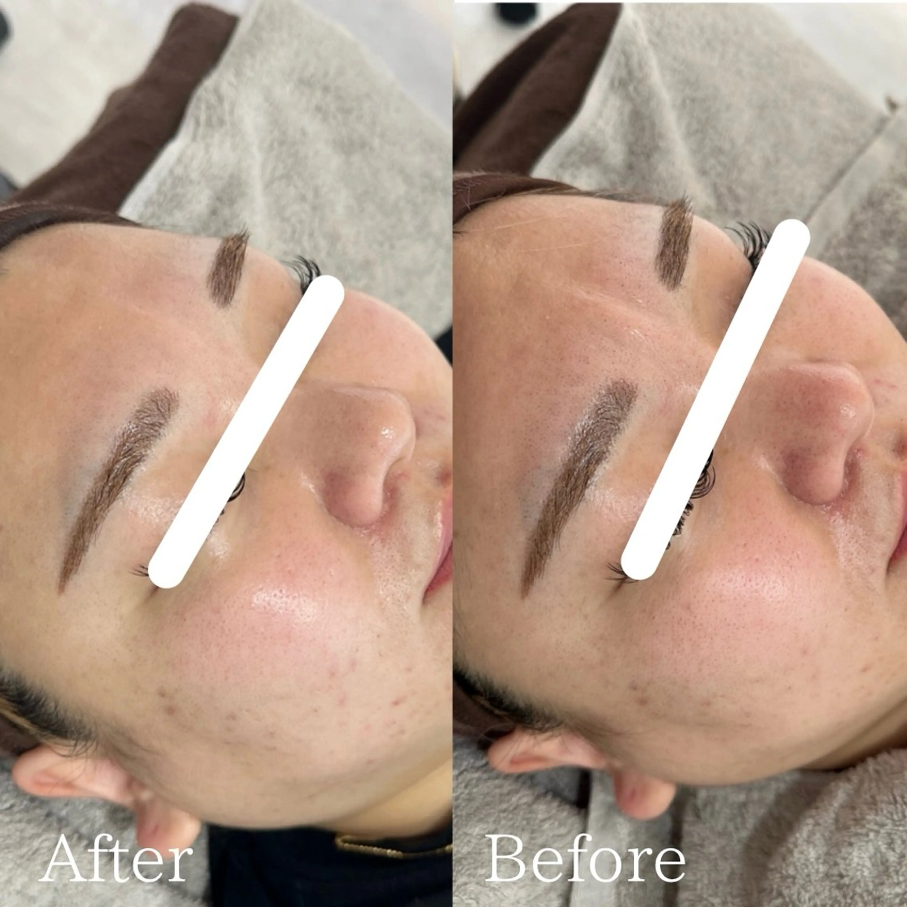 エステ lafleur Yurinaのエステ・リラクイメージ