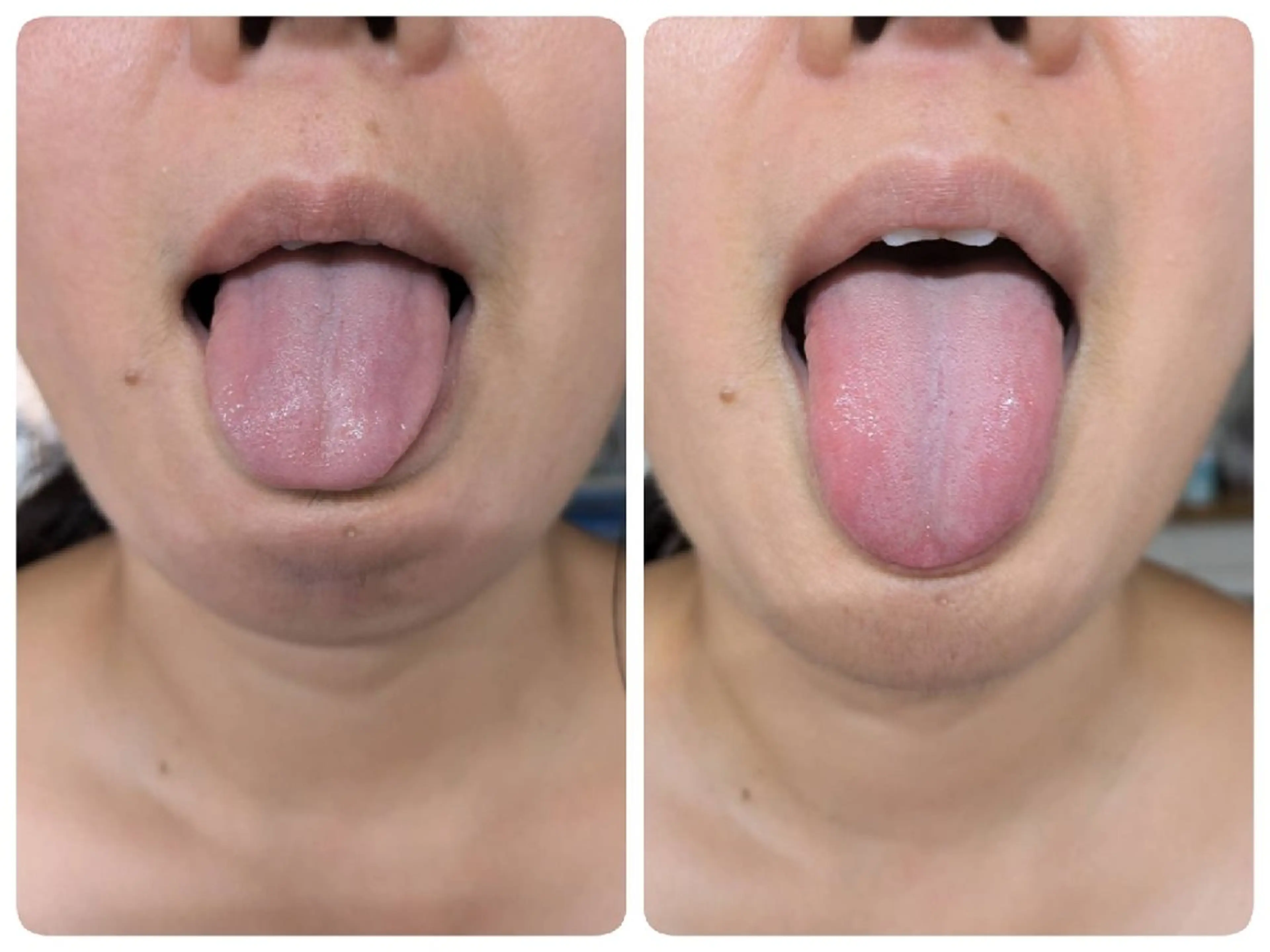 リラク はなえみの森所属・上戸 千瑞のエステ・リラクイメージ