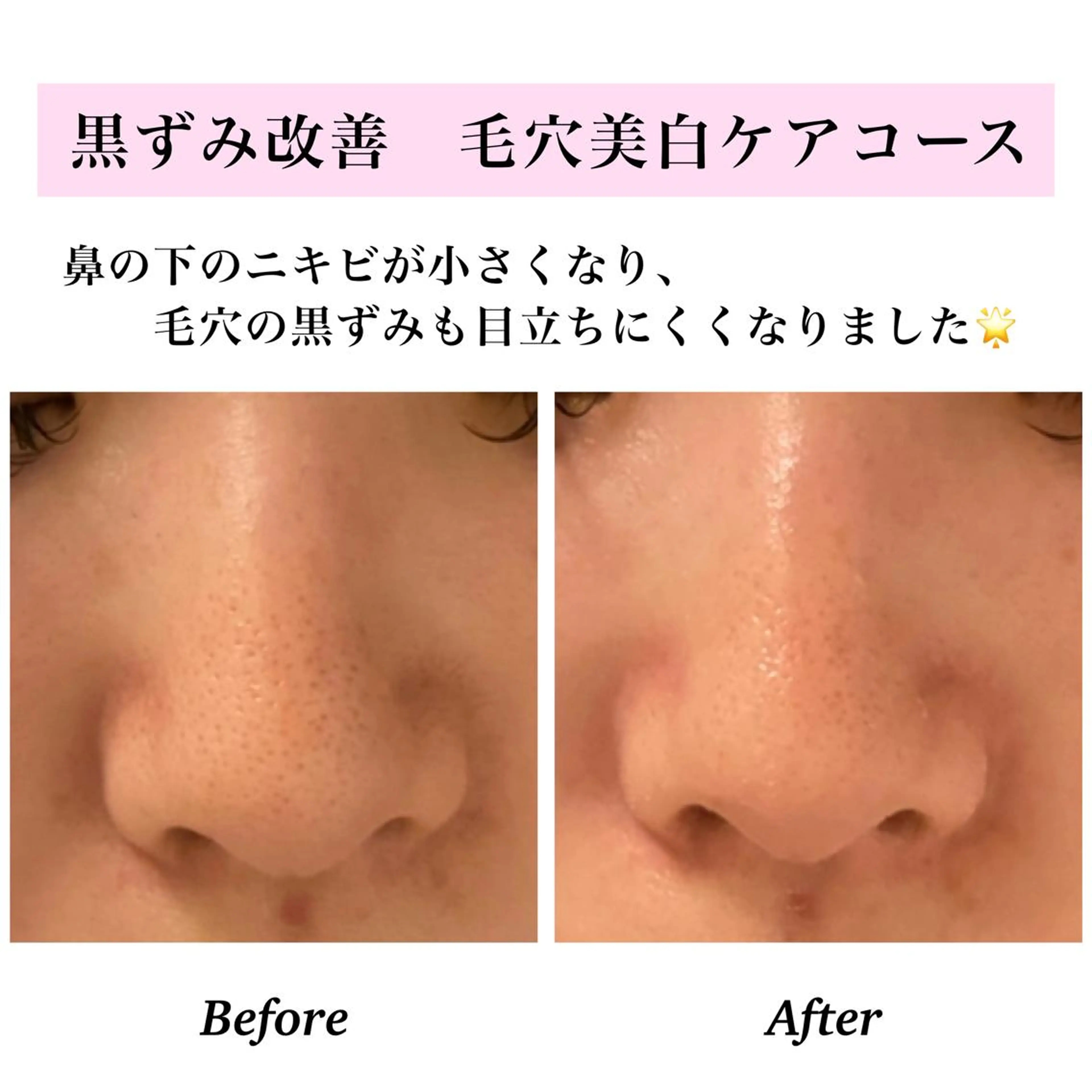 エステ リラク Bellesthe （ベルエステ）のエステ・リラクイメージ