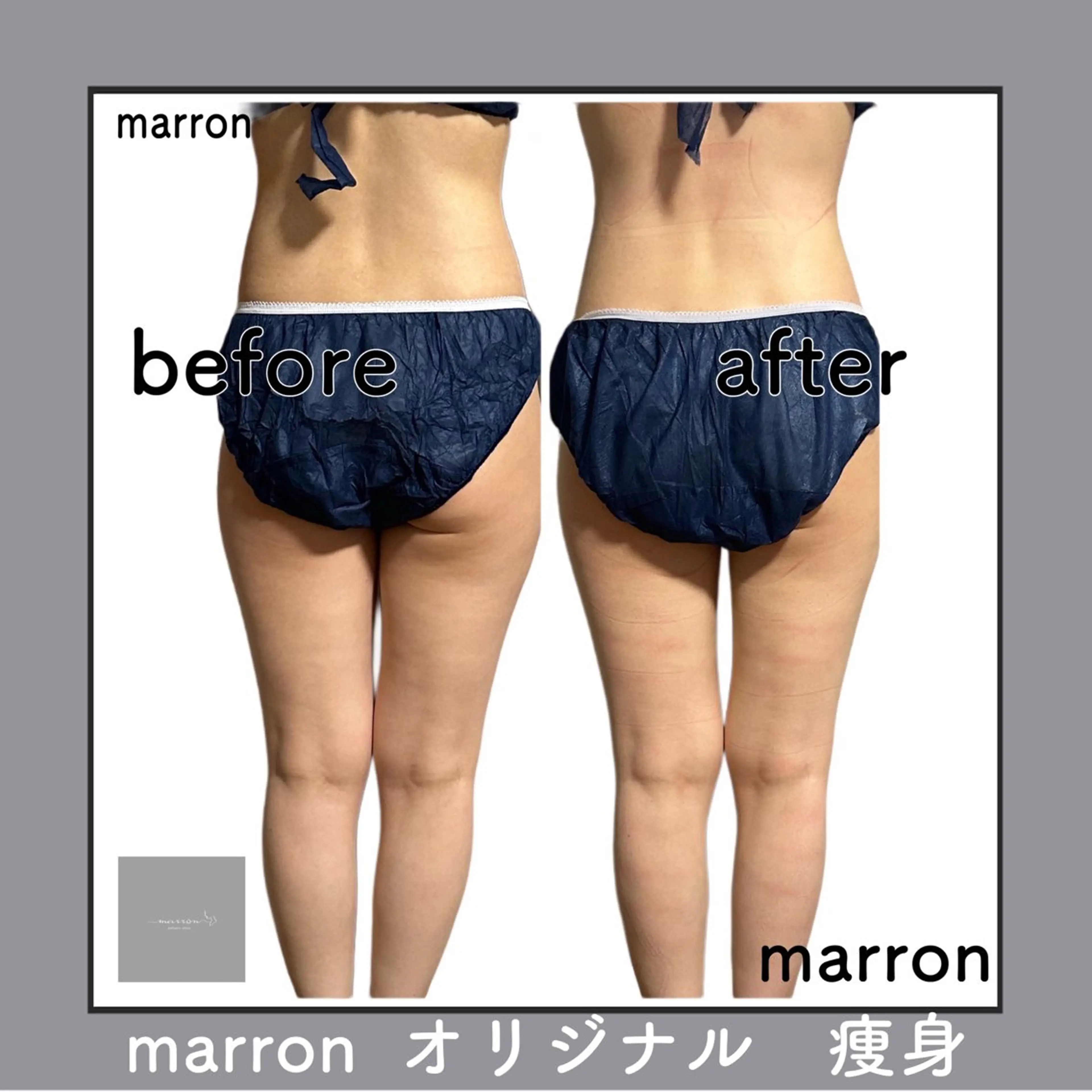 marron所属・痩身ハイパーナイフ ララピールリアボーテのエステ・リラクイメージ