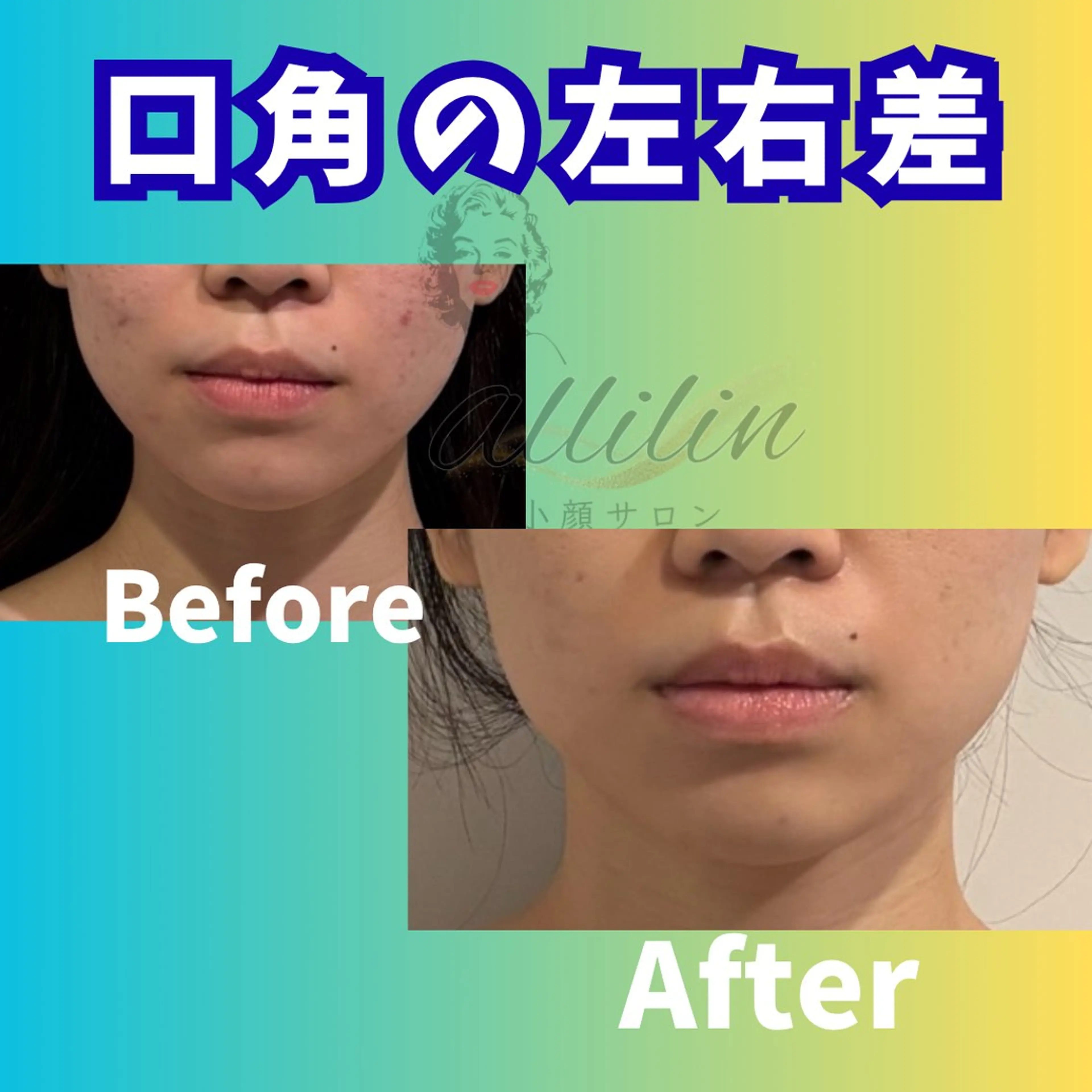 💎小顔ｻﾛﾝ アリリン銀座💎のエステ・リラクイメージ