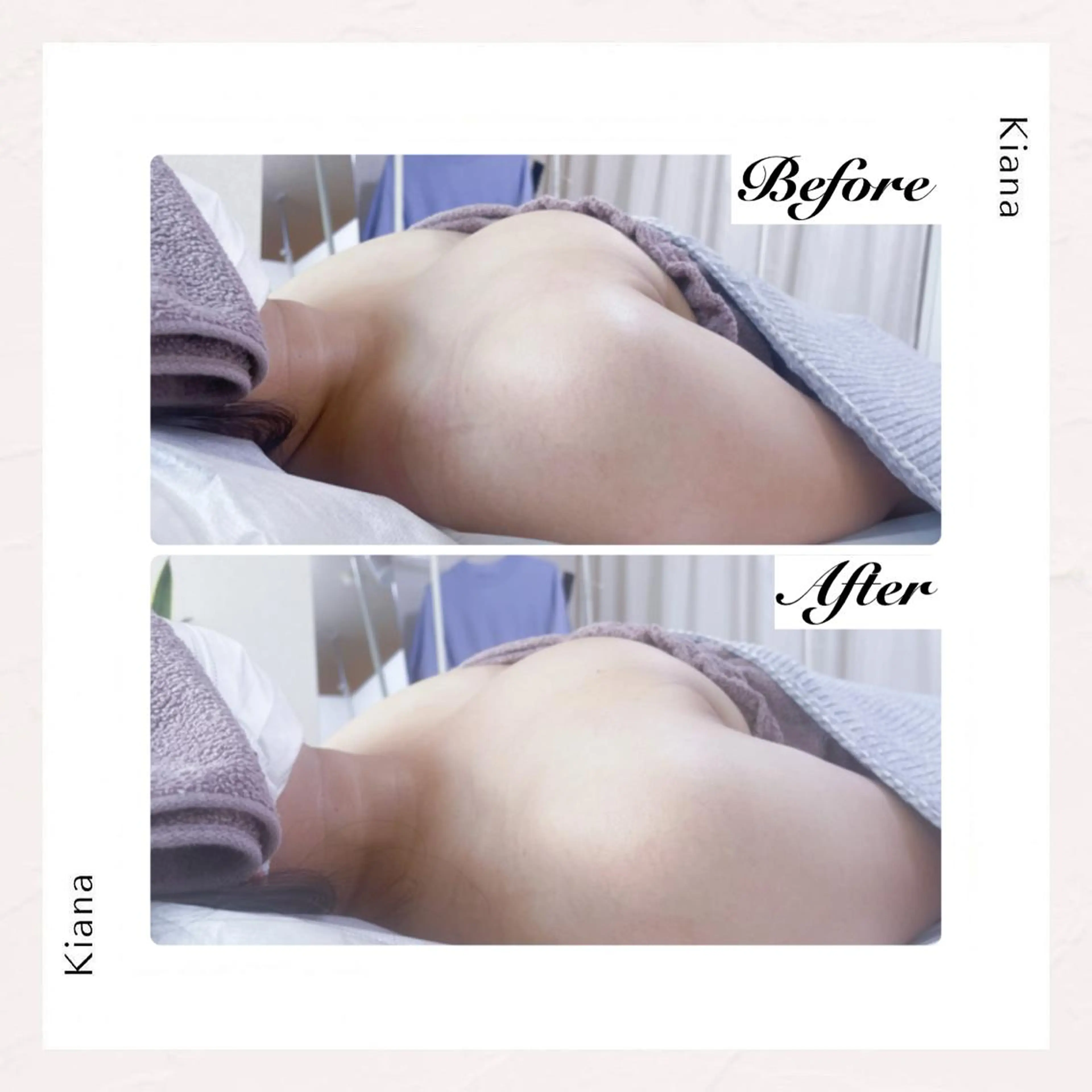 エステ リラク バスト専門Kiana 風のエステ・リラクイメージ