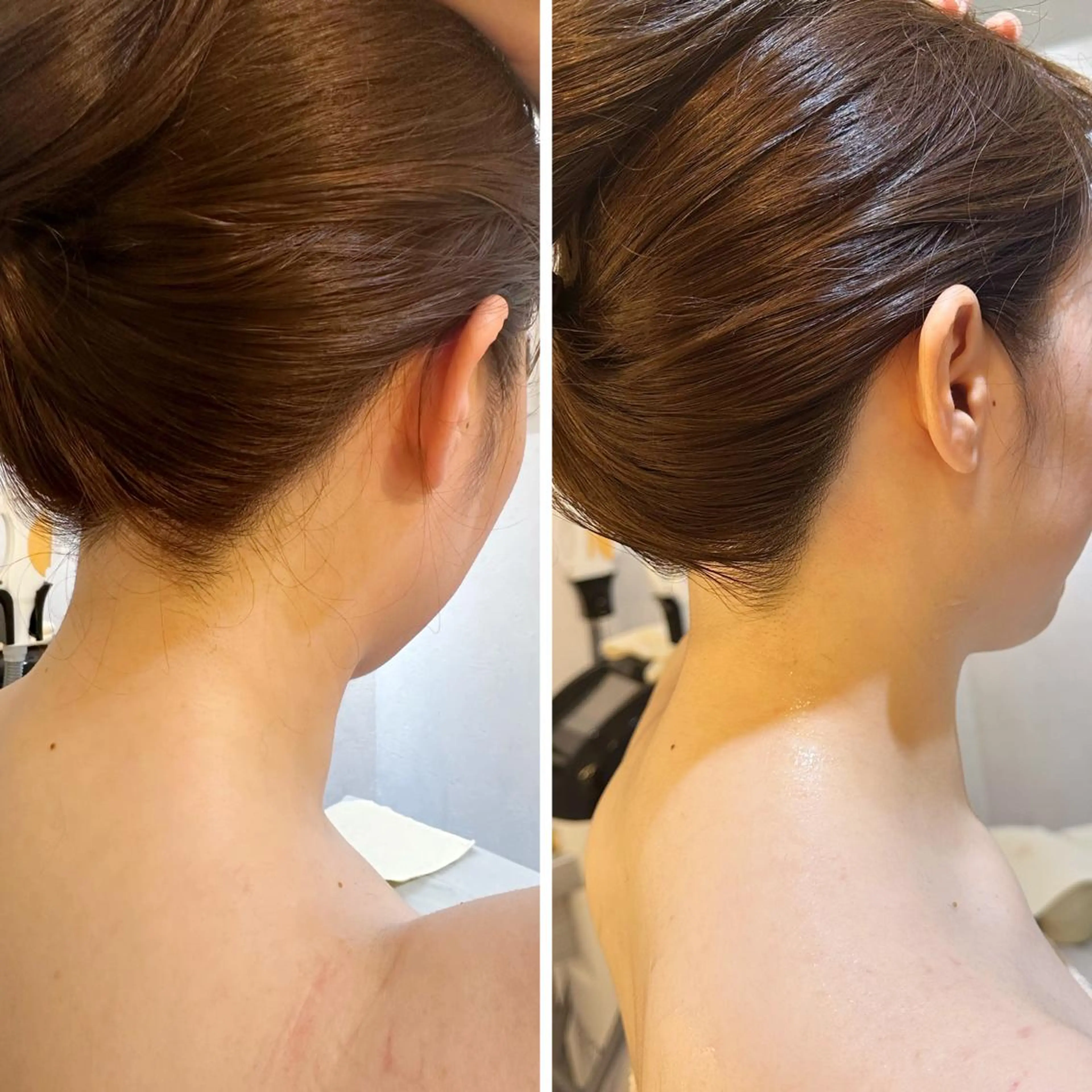 うなじ脱毛/美肌脱毛 LABELのエステ・リラクイメージ