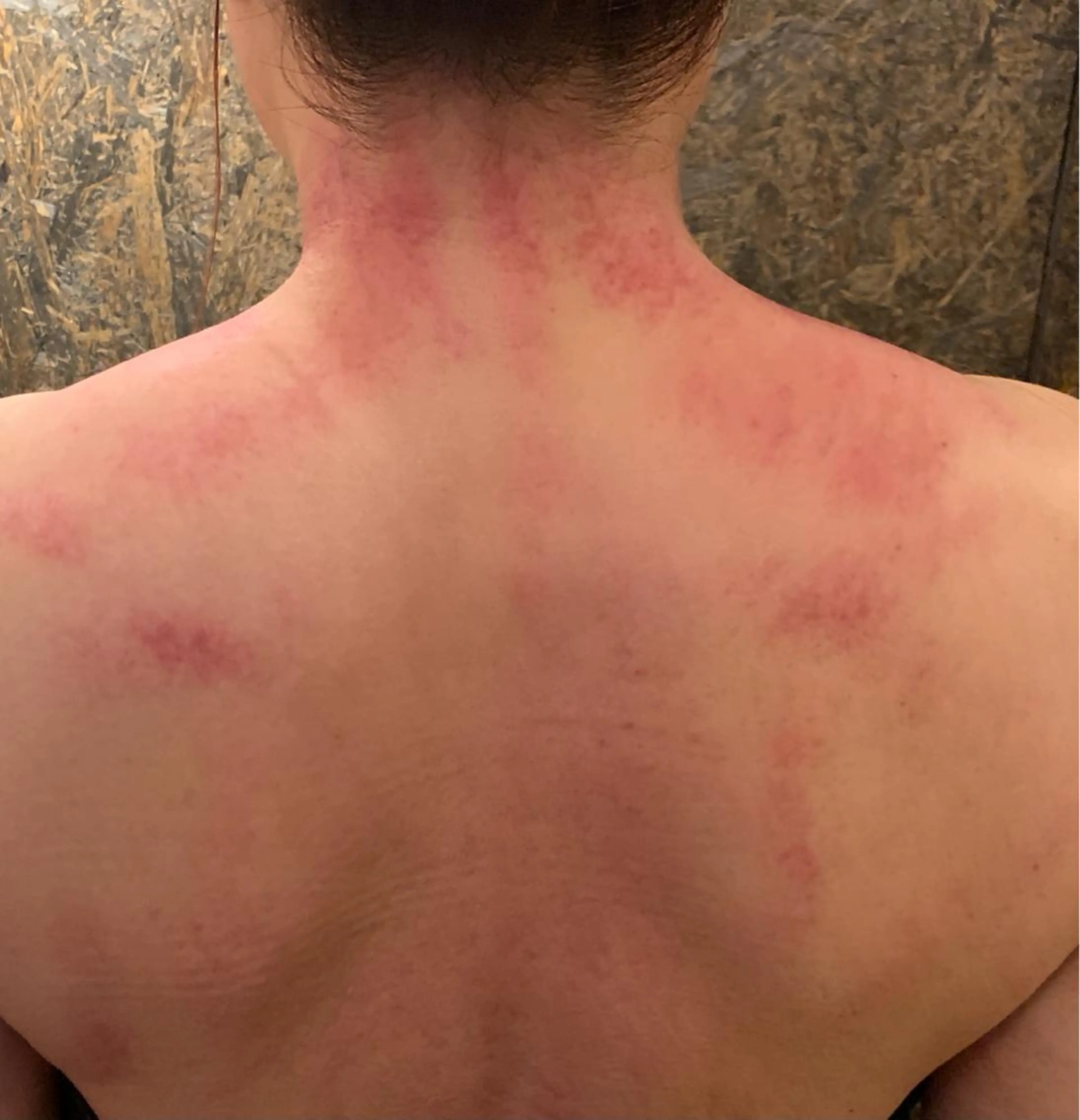 オリジナル刮痧　スペシャルコース　(かっさ＆ほぐしMIX  全身　約120分、足湯付き)の写真