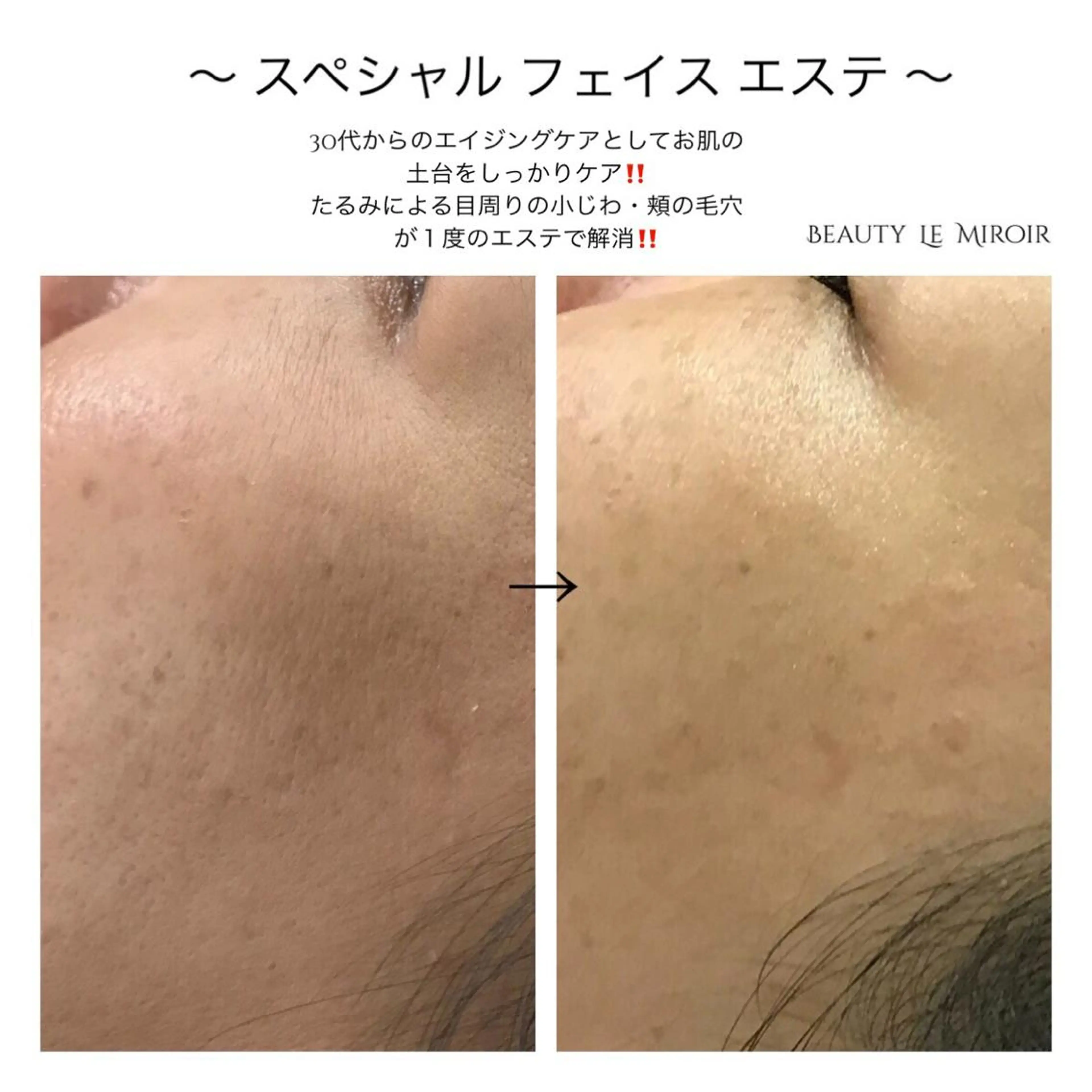 ビューティー ミロワールのエステ・リラクイメージ