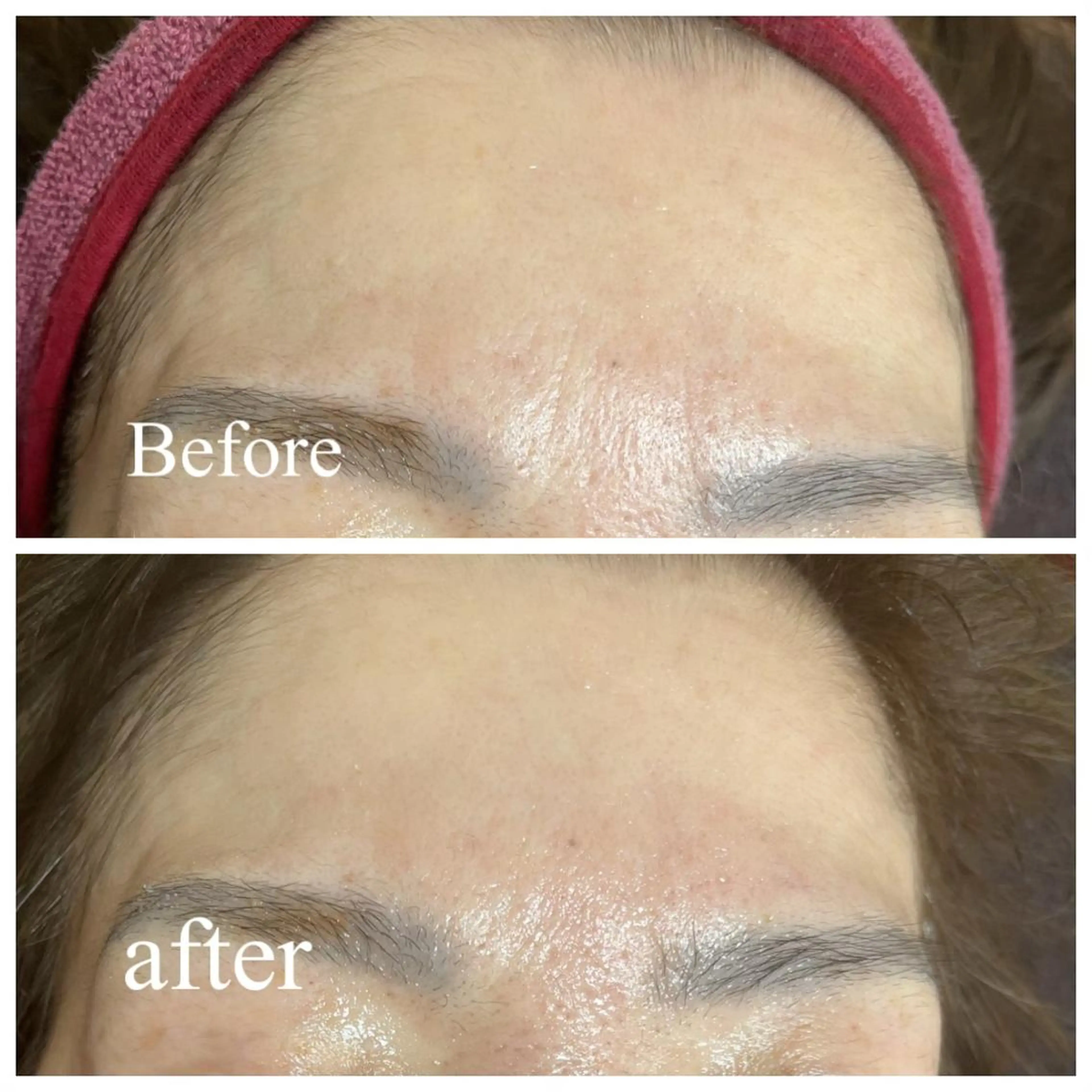 肌質改善サロン facialmoonのエステ・リラクイメージ