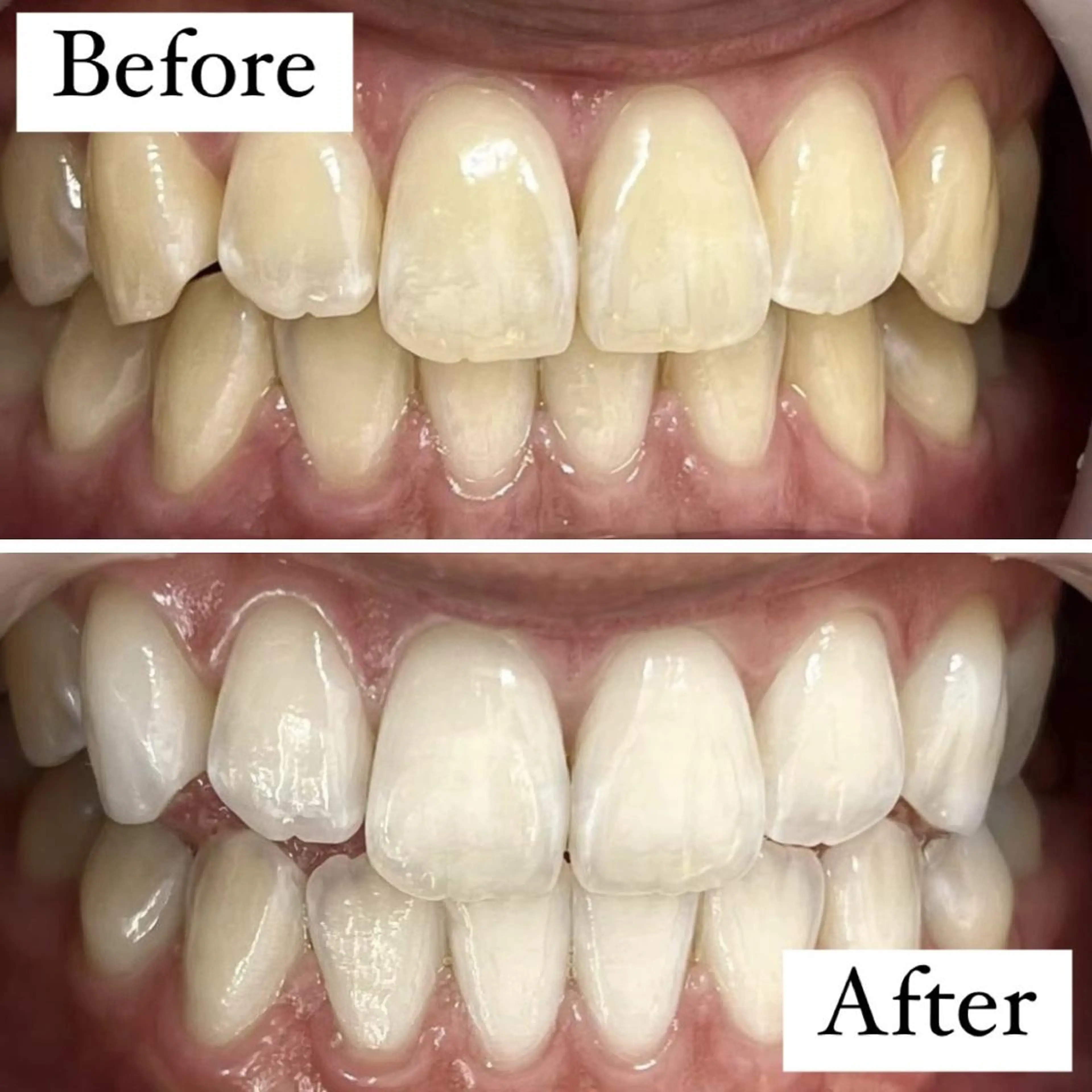 その他 LBSホワイトニング 銀座店💎スタッフ峯のその他イメージ