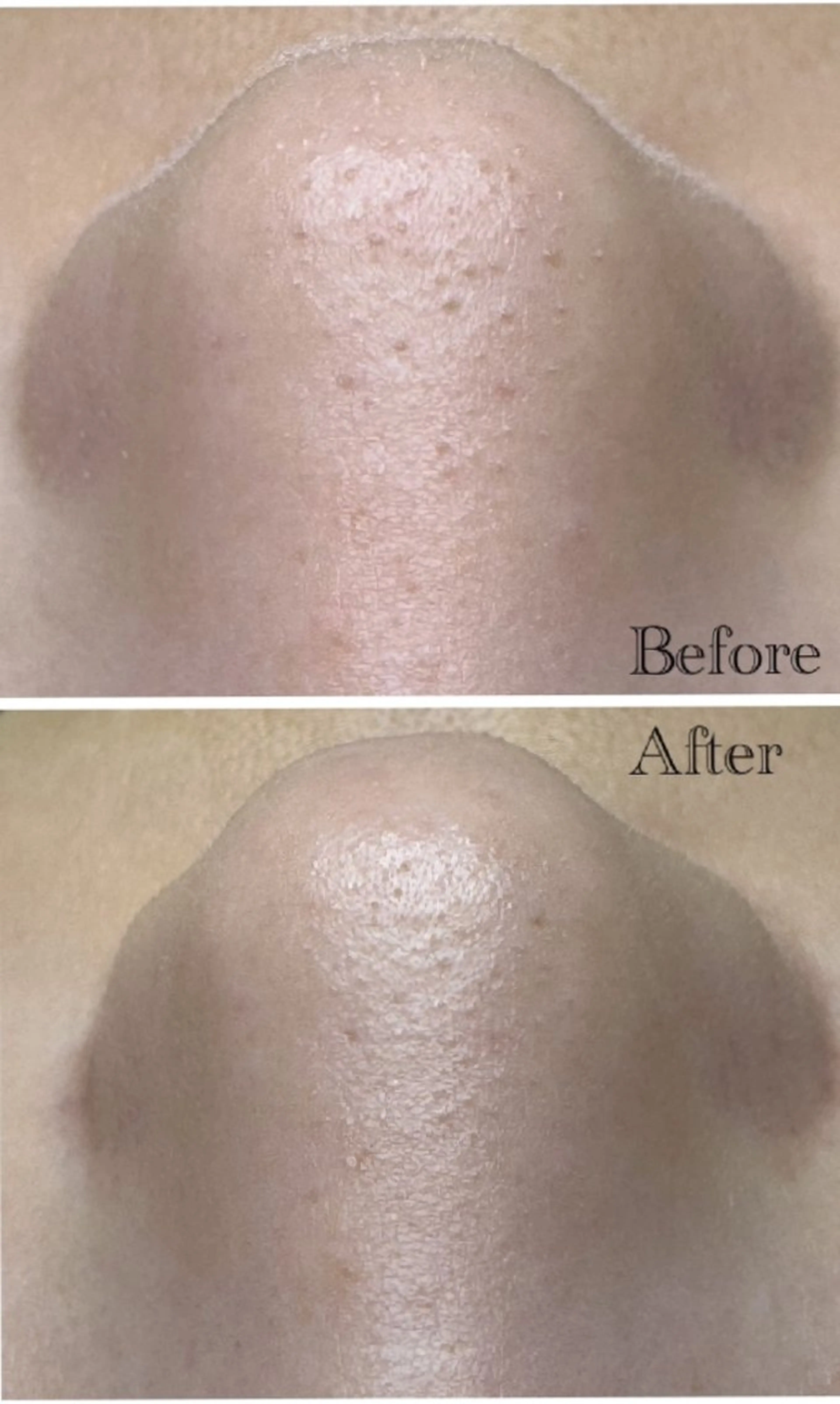 フェイシャル&アイブロウサロンRRR所属・アイブロウワックス フェイシャルサロンの眉毛・アイブロウイメージ