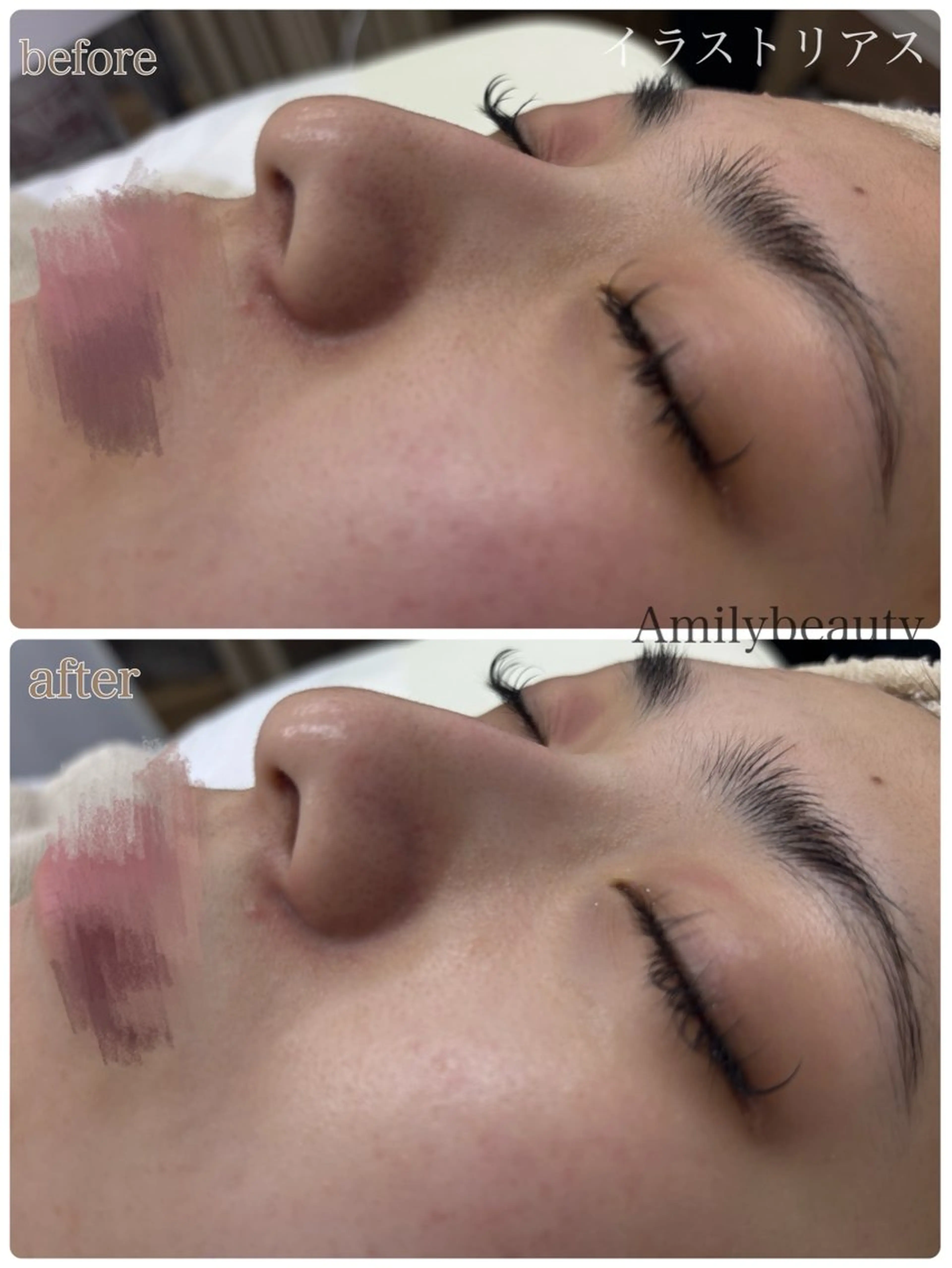 エステ Amilybeauty所属・Amily beauty 毛利のその他イメージ