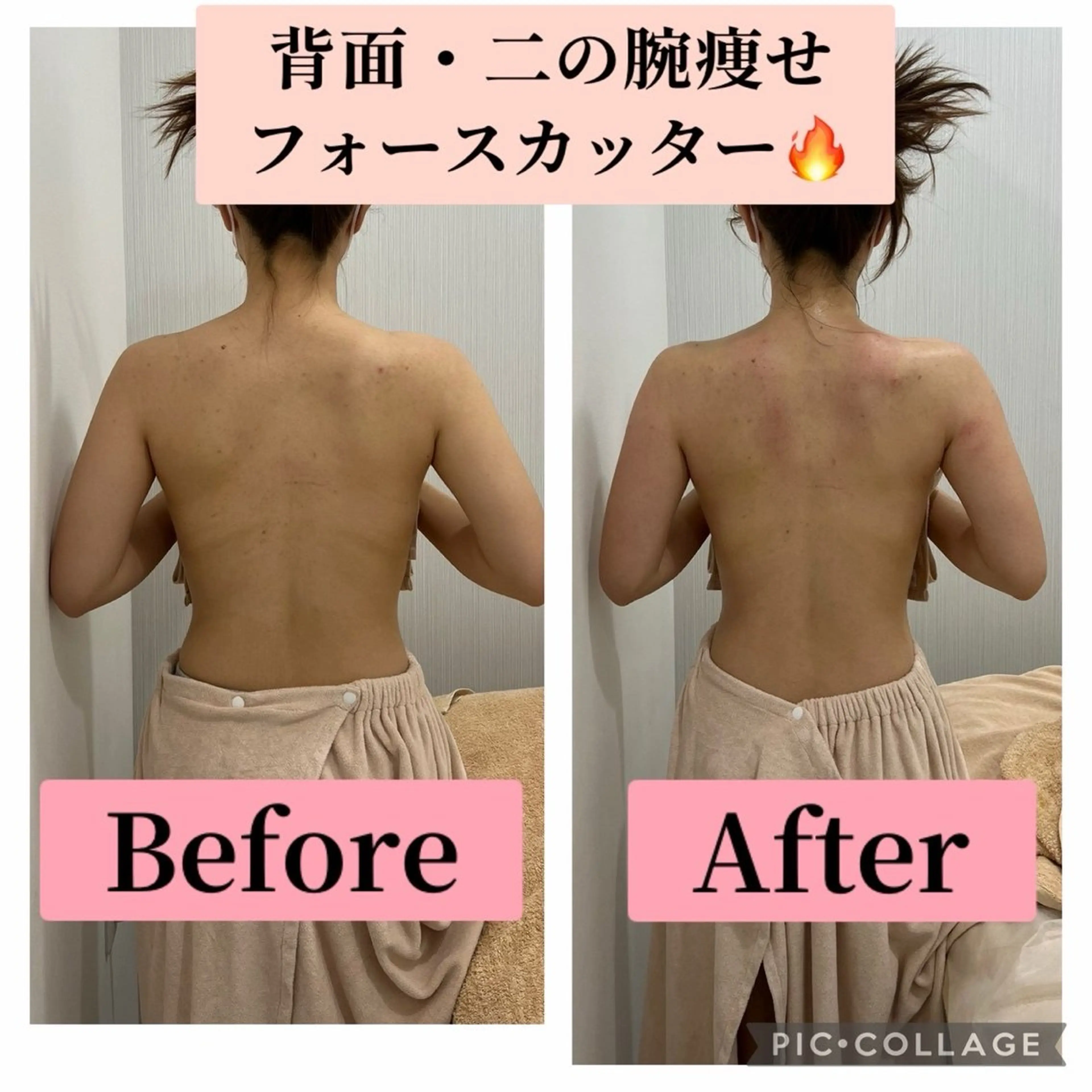 エステ ブライダル痩身×脱毛 尼崎駅前サロンのエステ・リラクイメージ