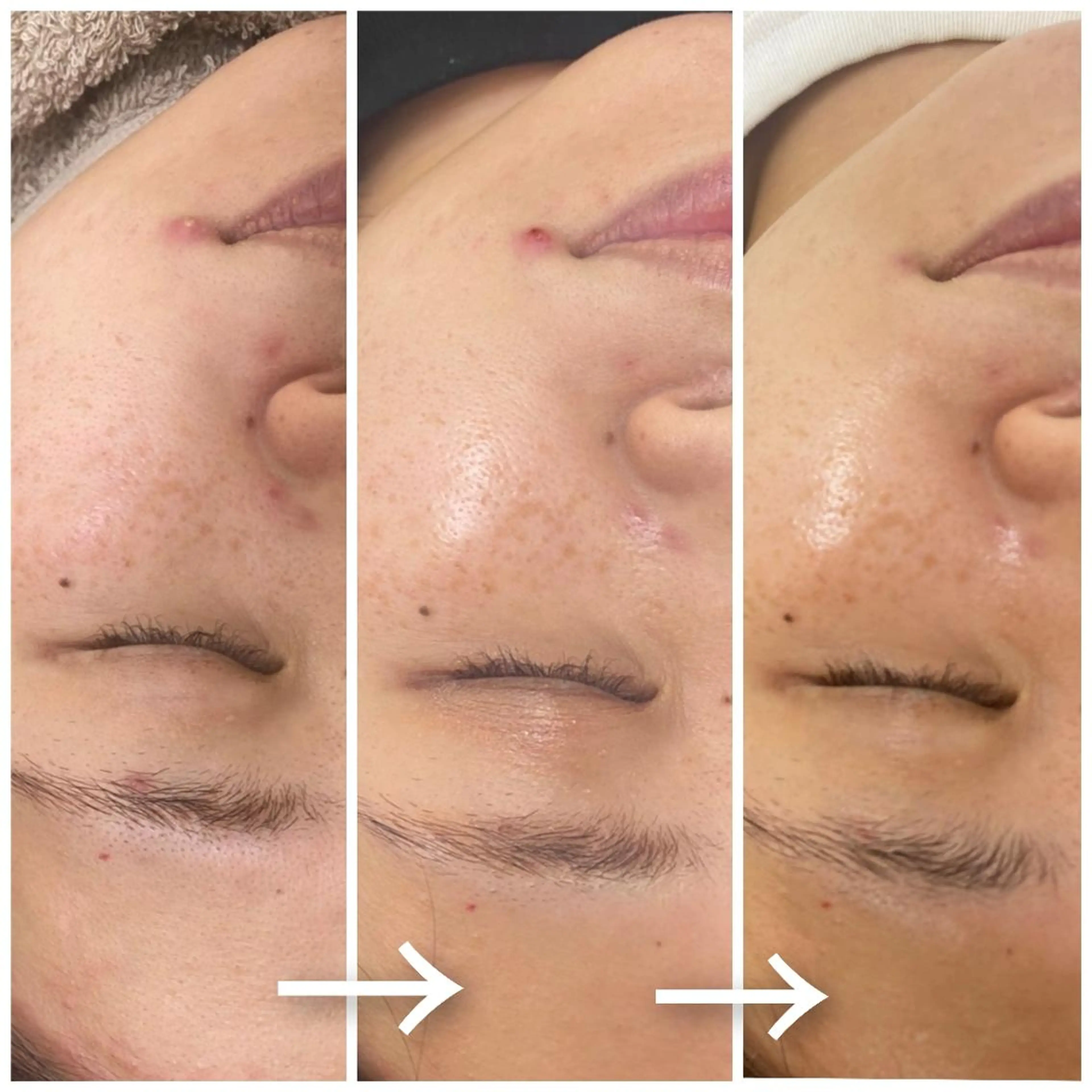 脱毛 beauty salon by BMbm所属・名倉 彩乃のエステ・リラクイメージ